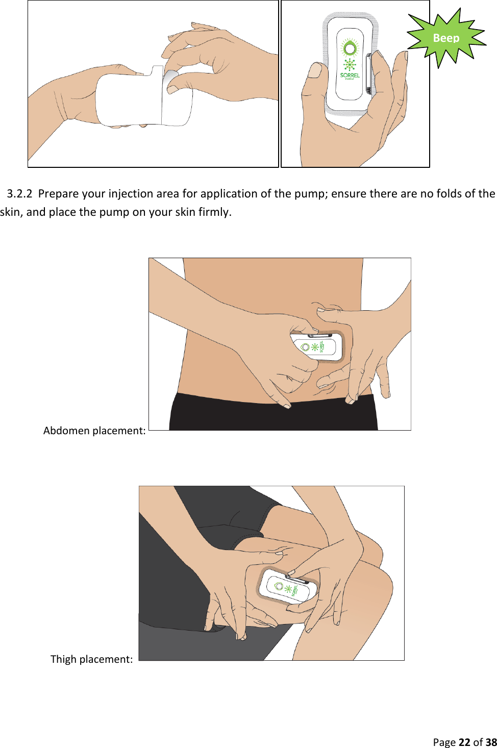  Page 22 of 38  3.2.2 Prepare your injection area for application of the pump; ensure there are no folds of the skin, and place the pump on your skin firmly.  Abdomen placement:   Thigh placement:    Beep 