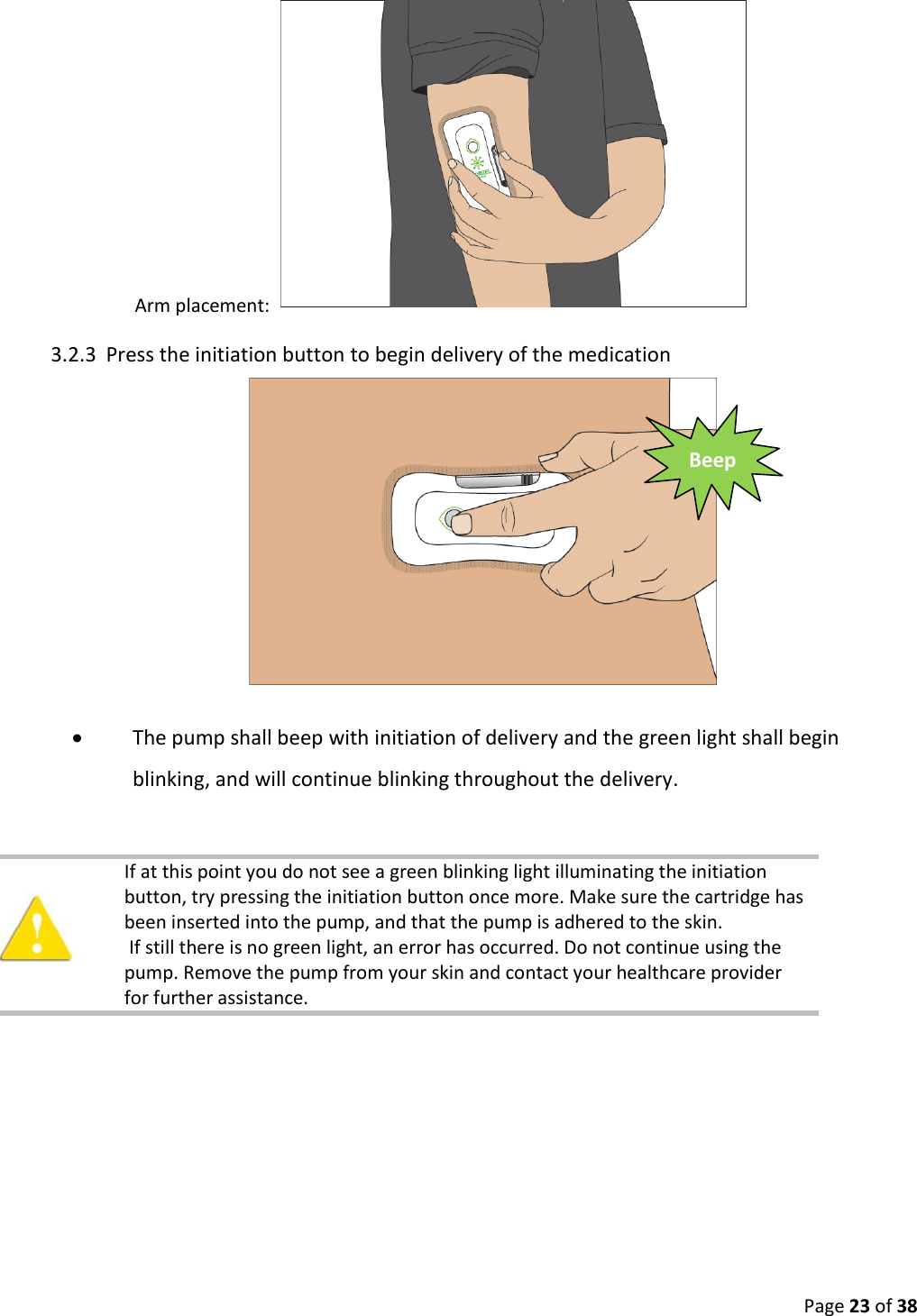  Page 23 of 38 Arm placement:   3.2.3 Press the initiation button to begin delivery of the medication   The pump shall beep with initiation of delivery and the green light shall begin blinking, and will continue blinking throughout the delivery.      If at this point you do not see a green blinking light illuminating the initiation button, try pressing the initiation button once more. Make sure the cartridge has been inserted into the pump, and that the pump is adhered to the skin.  If still there is no green light, an error has occurred. Do not continue using the pump. Remove the pump from your skin and contact your healthcare provider for further assistance.    Beep 