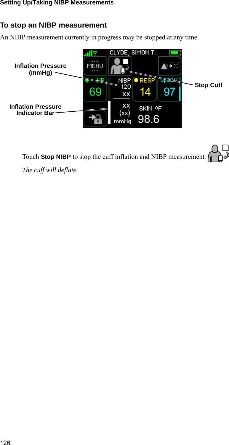 Setting Up/Taking NIBP Measurements 126To stop an NIBP measurement An NIBP measurement currently in progress may be stopped at any time.Touch Stop NIBP to stop the cuff inflation and NIBP measurement. The cuff will deflate.Inflation PressureIndicator BarInflation Pressure(mmHg)Stop Cuff