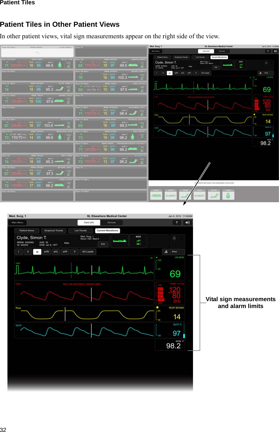 Patient Tiles 32Patient Tiles in Other Patient ViewsIn other patient views, vital sign measurements appear on the right side of the view.Vital sign measurementsand alarm limits