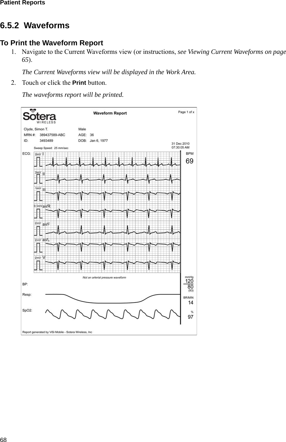 Patient Reports 686.5.2  WaveformsTo Print the Waveform Report1. Navigate to the Current Waveforms view (or instructions, see Viewing Current Waveforms on page65).The Current Waveforms view will be displayed in the Work Area.2. Touch or click the Print button.The waveforms report will be printed.