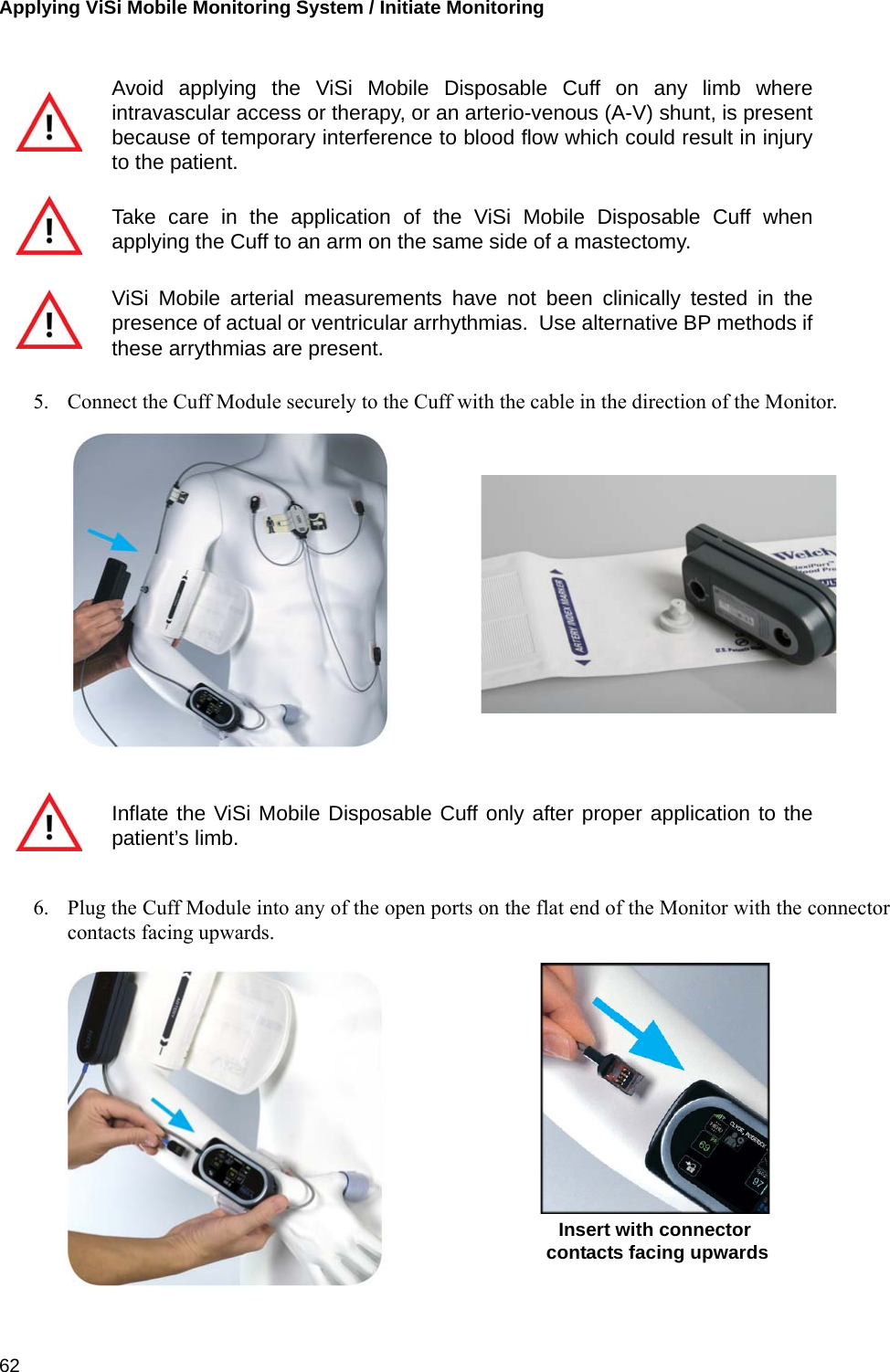 Applying ViSi Mobile Monitoring System / Initiate Monitoring 625. Connect the Cuff Module securely to the Cuff with the cable in the direction of the Monitor.6. Plug the Cuff Module into any of the open ports on the flat end of the Monitor with the connectorcontacts facing upwards.Avoid applying the ViSi Mobile Disposable Cuff on any limb whereintravascular access or therapy, or an arterio-venous (A-V) shunt, is presentbecause of temporary interference to blood flow which could result in injuryto the patient.Take care in the application of the ViSi Mobile Disposable Cuff whenapplying the Cuff to an arm on the same side of a mastectomy.ViSi Mobile arterial measurements have not been clinically tested in thepresence of actual or ventricular arrhythmias.  Use alternative BP methods ifthese arrythmias are present.Inflate the ViSi Mobile Disposable Cuff only after proper application to thepatient’s limb.Insert with connectorcontacts facing upwards