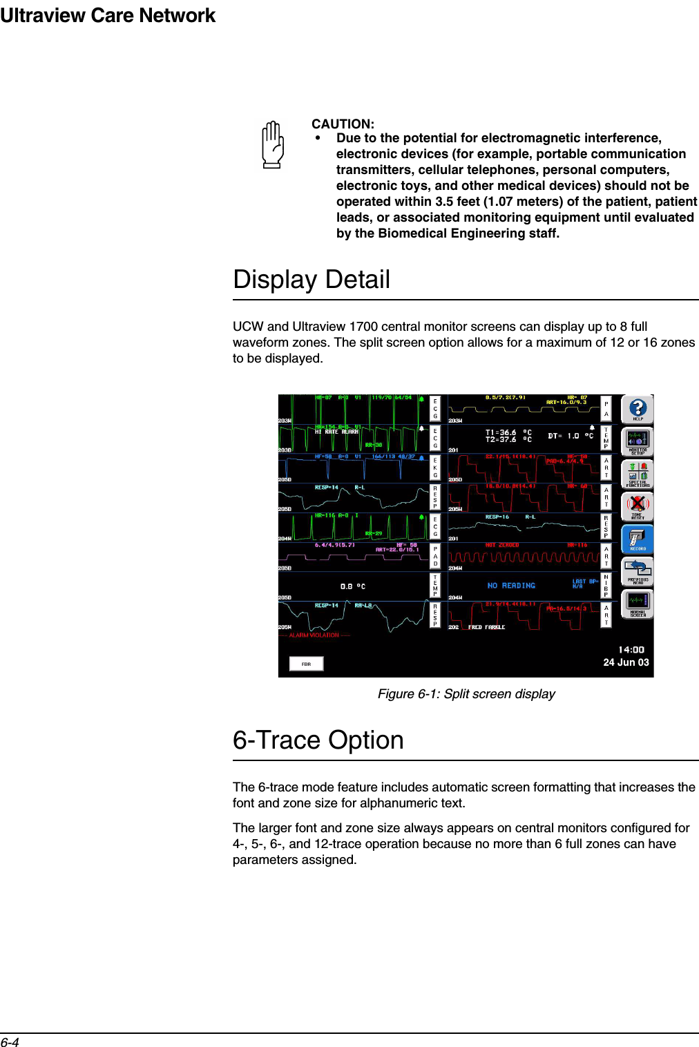 Ultraview Care Network6-4Display DetailUCW and Ultraview 1700 central monitor screens can display up to 8 full waveform zones. The split screen option allows for a maximum of 12 or 16 zones to be displayed. Figure 6-1: Split screen display6-Trace OptionThe 6-trace mode feature includes automatic screen formatting that increases the font and zone size for alphanumeric text.The larger font and zone size always appears on central monitors configured for 4-, 5-, 6-, and 12-trace operation because no more than 6 full zones can have parameters assigned. CAUTION:• Due to the potential for electromagnetic interference, electronic devices (for example, portable communication transmitters, cellular telephones, personal computers, electronic toys, and other medical devices) should not be operated within 3.5 feet (1.07 meters) of the patient, patient leads, or associated monitoring equipment until evaluated by the Biomedical Engineering staff.24 Jun 03