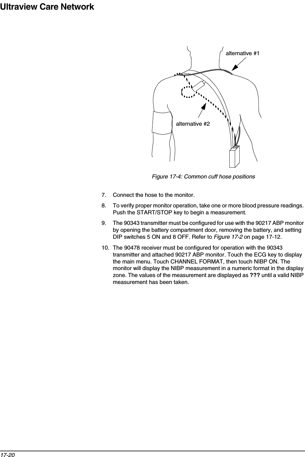 Ultraview Care Network17-20Figure 17-4: Common cuff hose positions7. Connect the hose to the monitor.8. To verify proper monitor operation, take one or more blood pressure readings. Push the START/STOP key to begin a measurement.9. The 90343 transmitter must be configured for use with the 90217 ABP monitor by opening the battery compartment door, removing the battery, and setting DIP switches 5 ON and 8 OFF. Refer to Figure 17-2 on page 17-12.10. The 90478 receiver must be configured for operation with the 90343 transmitter and attached 90217 ABP monitor. Touch the ECG key to display the main menu. Touch CHANNEL FORMAT, then touch NIBP ON. The monitor will display the NIBP measurement in a numeric format in the display zone. The values of the measurement are displayed as ??? until a valid NIBP measurement has been taken. alternative #1alternative #2