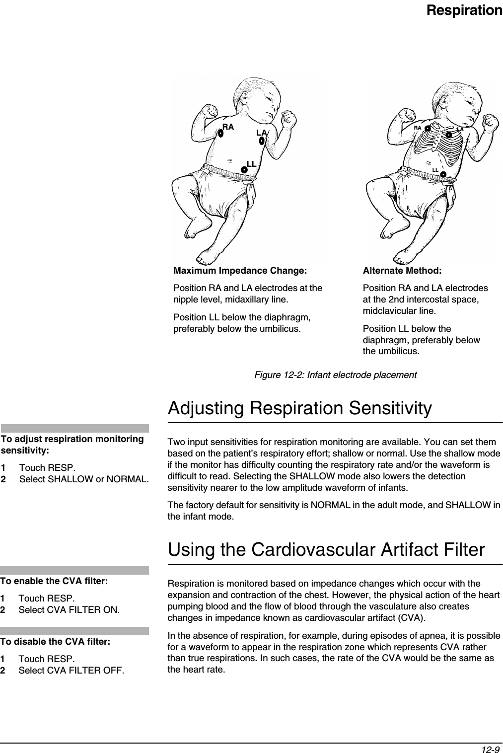 Respiration12-9 Figure 12-2: Infant electrode placementAdjusting Respiration SensitivityTwo input sensitivities for respiration monitoring are available. You can set them based on the patient’s respiratory effort; shallow or normal. Use the shallow mode if the monitor has difficulty counting the respiratory rate and/or the waveform is difficult to read. Selecting the SHALLOW mode also lowers the detection sensitivity nearer to the low amplitude waveform of infants.The factory default for sensitivity is NORMAL in the adult mode, and SHALLOW in the infant mode.Using the Cardiovascular Artifact FilterRespiration is monitored based on impedance changes which occur with the expansion and contraction of the chest. However, the physical action of the heart pumping blood and the flow of blood through the vasculature also creates changes in impedance known as cardiovascular artifact (CVA).In the absence of respiration, for example, during episodes of apnea, it is possible for a waveform to appear in the respiration zone which represents CVA rather than true respirations. In such cases, the rate of the CVA would be the same as the heart rate.LARALLAlternate Method:Position RA and LA electrodes at the 2nd intercostal space, midclavicular line.Position LL below the diaphragm, preferably below the umbilicus.RA LALLMaximum Impedance Change:Position RA and LA electrodes at the nipple level, midaxillary line.Position LL below the diaphragm, preferably below the umbilicus.To adjust respiration monitoring sensitivity: 1Touch RESP.2Select SHALLOW or NORMAL.To enable the CVA filter: 1Touch RESP. 2Select CVA FILTER ON.To disable the CVA filter: 1Touch RESP.2Select CVA FILTER OFF.