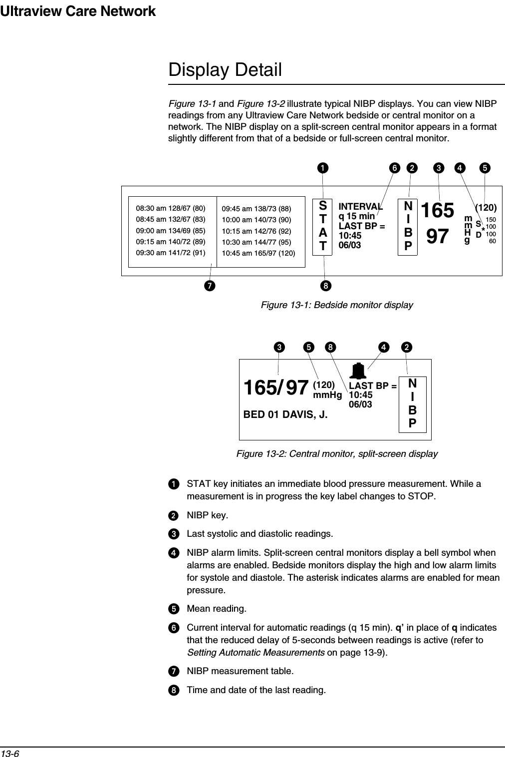 Ultraview Care Network13-6Display DetailFigure 13-1 and Figure 13-2 illustrate typical NIBP displays. You can view NIBP readings from any Ultraview Care Network bedside or central monitor on a network. The NIBP display on a split-screen central monitor appears in a format slightly different from that of a bedside or full-screen central monitor.Figure 13-1: Bedside monitor displayFigure 13-2: Central monitor, split-screen displayᕡSTAT key initiates an immediate blood pressure measurement. While a measurement is in progress the key label changes to STOP.ᕢNIBP key.ᕣLast systolic and diastolic readings.ᕤNIBP alarm limits. Split-screen central monitors display a bell symbol when alarms are enabled. Bedside monitors display the high and low alarm limits for systole and diastole. The asterisk indicates alarms are enabled for mean pressure.ᕥMean reading.ᕦCurrent interval for automatic readings (q 15 min). q’ in place of q indicates that the reduced delay of 5-seconds between readings is active (refer to Setting Automatic Measurements on page 13-9).ᕧNIBP measurement table.ᕨTime and date of the last reading.08:30 am 128/67 (80)08:45 am 132/67 (83)09:00 am 134/69 (85)09:15 am 140/72 (89)09:30 am 141/72 (91)09:45 am 138/73 (88)10:00 am 140/73 (90)10:15 am 142/76 (92)10:30 am 144/77 (95)10:45 am 165/97 (120)INTERVALq 15 min10:4506/03LAST BP = NIBP16597mmHg(120)SD15010010060*ᕧᕨᕦᕢ ᕣ ᕤ ᕥSTATᕡNIBP165/97 10:4506/03LAST BP = mmHg(120)BED 01 DAVIS, J.ᕣᕥᕨ ᕤᕢ