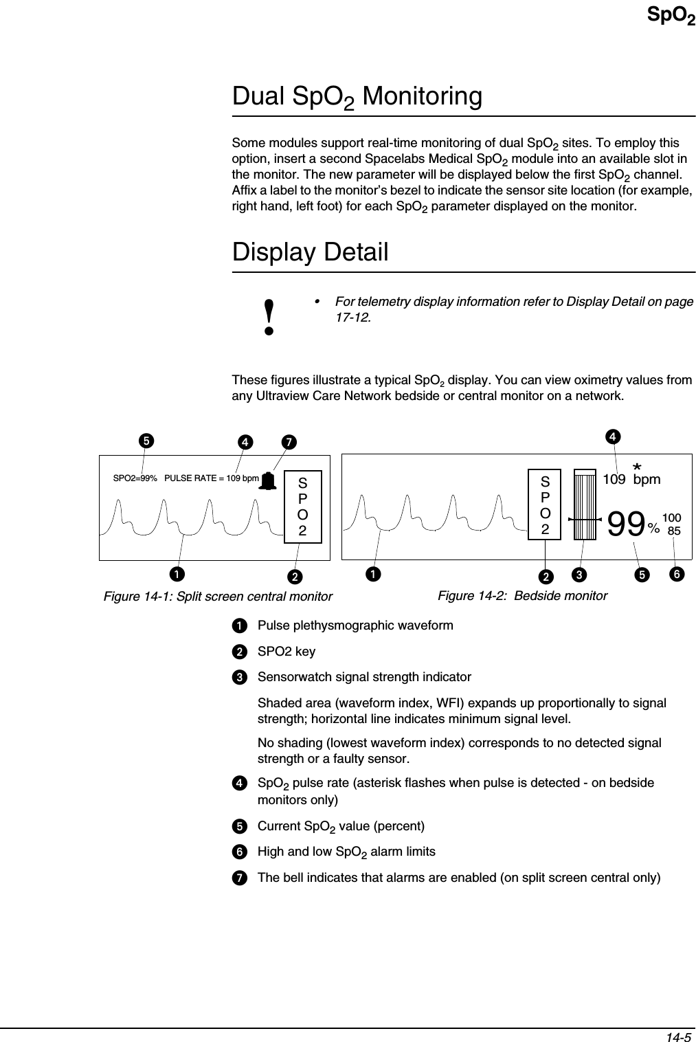 SpO214-5 Dual SpO2 MonitoringSome modules support real-time monitoring of dual SpO2 sites. To employ this option, insert a second Spacelabs Medical SpO2 module into an available slot in the monitor. The new parameter will be displayed below the first SpO2 channel. Affix a label to the monitor’s bezel to indicate the sensor site location (for example, right hand, left foot) for each SpO2 parameter displayed on the monitor.Display DetailThese figures illustrate a typical SpO2 display. You can view oximetry values from any Ultraview Care Network bedside or central monitor on a network.ᕡPulse plethysmographic waveformᕢSPO2 keyᕣSensorwatch signal strength indicatorShaded area (waveform index, WFI) expands up proportionally to signal strength; horizontal line indicates minimum signal level.No shading (lowest waveform index) corresponds to no detected signal strength or a faulty sensor. ᕤSpO2 pulse rate (asterisk flashes when pulse is detected - on bedside monitors only)ᕥCurrent SpO2 value (percent)ᕦHigh and low SpO2 alarm limitsᕧThe bell indicates that alarms are enabled (on split screen central only)!• For telemetry display information refer to Display Detail on page 17-12.99109  bpm%10085*SPO2=99%   PULSE RATE = 109 bpmFigure 14-1: Split screen central monitor Figure 14-2:  Bedside monitorᕥᕤᕧᕡᕢᕡᕢᕣᕤᕥᕦSPO2SPO2