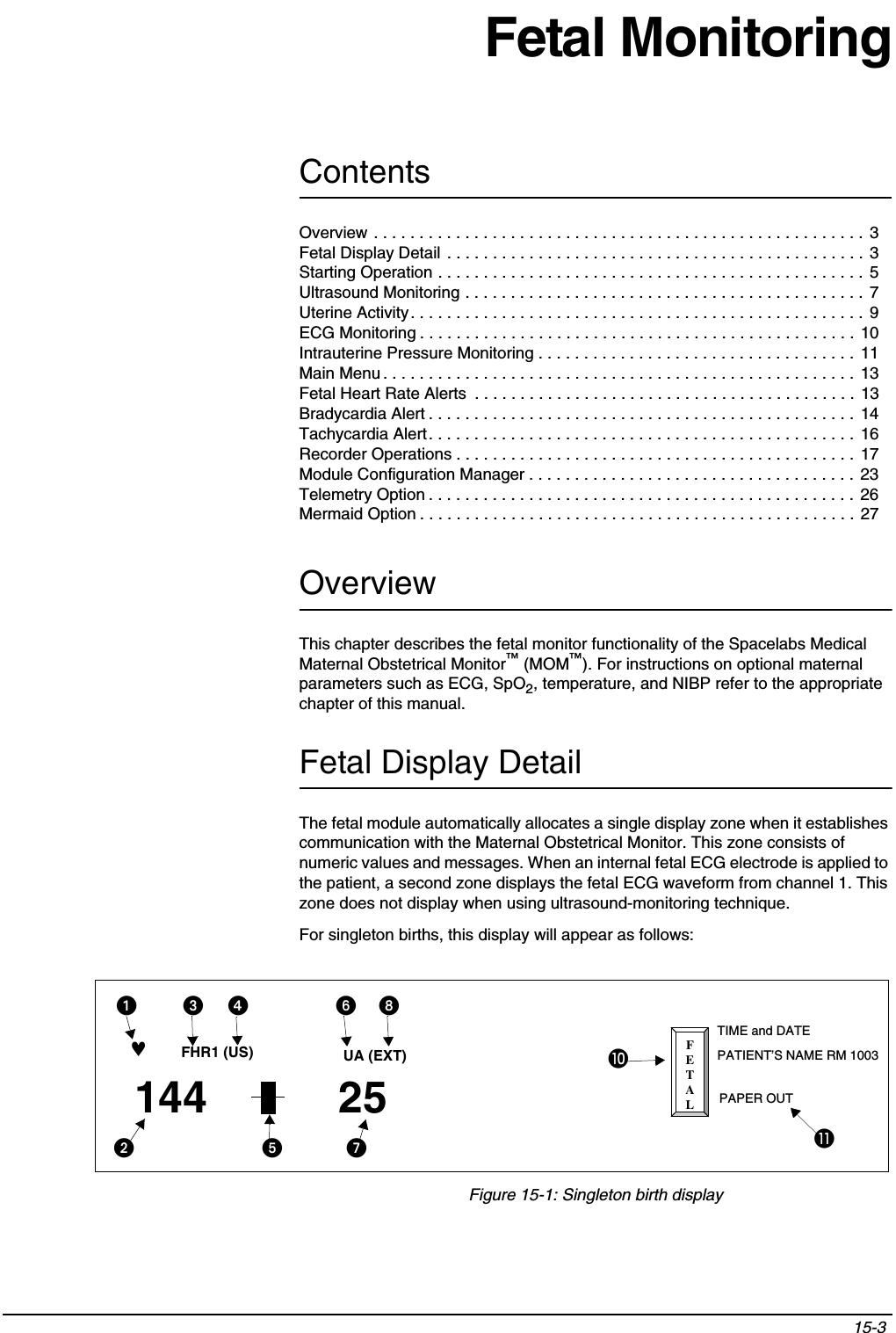 Contents15-3 Overview . . . . . . . . . . . . . . . . . . . . . . . . . . . . . . . . . . . . . . . . . . . . . . . . . . . . . . 3Fetal Display Detail . . . . . . . . . . . . . . . . . . . . . . . . . . . . . . . . . . . . . . . . . . . . . . 3Starting Operation . . . . . . . . . . . . . . . . . . . . . . . . . . . . . . . . . . . . . . . . . . . . . . . 5Ultrasound Monitoring . . . . . . . . . . . . . . . . . . . . . . . . . . . . . . . . . . . . . . . . . . . . 7Uterine Activity. . . . . . . . . . . . . . . . . . . . . . . . . . . . . . . . . . . . . . . . . . . . . . . . . . 9ECG Monitoring . . . . . . . . . . . . . . . . . . . . . . . . . . . . . . . . . . . . . . . . . . . . . . . . 10Intrauterine Pressure Monitoring . . . . . . . . . . . . . . . . . . . . . . . . . . . . . . . . . . .  11Main Menu . . . . . . . . . . . . . . . . . . . . . . . . . . . . . . . . . . . . . . . . . . . . . . . . . . . . 13Fetal Heart Rate Alerts  . . . . . . . . . . . . . . . . . . . . . . . . . . . . . . . . . . . . . . . . . . 13Bradycardia Alert . . . . . . . . . . . . . . . . . . . . . . . . . . . . . . . . . . . . . . . . . . . . . . .  14Tachycardia Alert. . . . . . . . . . . . . . . . . . . . . . . . . . . . . . . . . . . . . . . . . . . . . . . 16Recorder Operations . . . . . . . . . . . . . . . . . . . . . . . . . . . . . . . . . . . . . . . . . . . .  17Module Configuration Manager . . . . . . . . . . . . . . . . . . . . . . . . . . . . . . . . . . . .  23Telemetry Option . . . . . . . . . . . . . . . . . . . . . . . . . . . . . . . . . . . . . . . . . . . . . . . 26Mermaid Option . . . . . . . . . . . . . . . . . . . . . . . . . . . . . . . . . . . . . . . . . . . . . . . . 27Fetal MonitoringOverviewThis chapter describes the fetal monitor functionality of the Spacelabs Medical Maternal Obstetrical Monitor™ (MOM™). For instructions on optional maternal parameters such as ECG, SpO2, temperature, and NIBP refer to the appropriate chapter of this manual.Fetal Display DetailThe fetal module automatically allocates a single display zone when it establishes communication with the Maternal Obstetrical Monitor. This zone consists of numeric values and messages. When an internal fetal ECG electrode is applied to the patient, a second zone displays the fetal ECG waveform from channel 1. This zone does not display when using ultrasound-monitoring technique. For singleton births, this display will appear as follows:Figure 15-1: Singleton birth displayFETAL67FHR1  (US)PATIENT’S NAMEROOM 1003144UC  (EXT)ALERT  ON♥144FHR1 (US)25UA (EXT)✑✓✑✓TIME and DATEPATIENT’S NAME RM 1003PAPER OUTᕡᕣᕤ ᕦᕨµ¸ᕧᕥᕢ