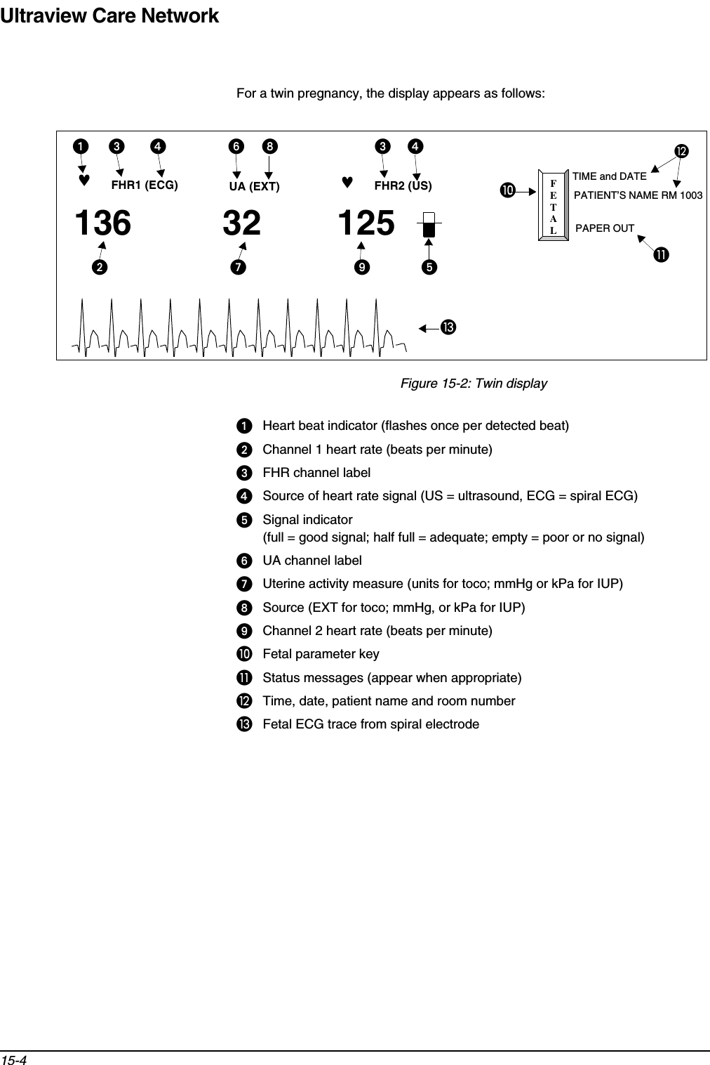 Ultraview Care Network15-4For a twin pregnancy, the display appears as follows: Figure 15-2: Twin displayᕡHeart beat indicator (flashes once per detected beat)ᕢChannel 1 heart rate (beats per minute)ᕣFHR channel labelᕤSource of heart rate signal (US = ultrasound, ECG = spiral ECG)ᕥSignal indicator (full = good signal; half full = adequate; empty = poor or no signal)ᕦUA channel labelᕧUterine activity measure (units for toco; mmHg or kPa for IUP)ᕨSource (EXT for toco; mmHg, or kPa for IUP) ᕩChannel 2 heart rate (beats per minute)µFetal parameter key¸Status messages (appear when appropriate)¹Time, date, patient name and room numberƸFetal ECG trace from spiral electrodeFETAL67FHR1  (US)PATIENT’S NAMEROOM 1003144UC  (EXT)ALERT  ON♥FHR1 (ECG)32UA (EXT) ♥125FHR2 (US)136TIME and DATEPATIENT’S NAME RM 1003PAPER OUTᕡᕣ ᕤ ᕦᕨ ᕣᕤµ¸ᕥᕩᕧᕢ¹Ƹ