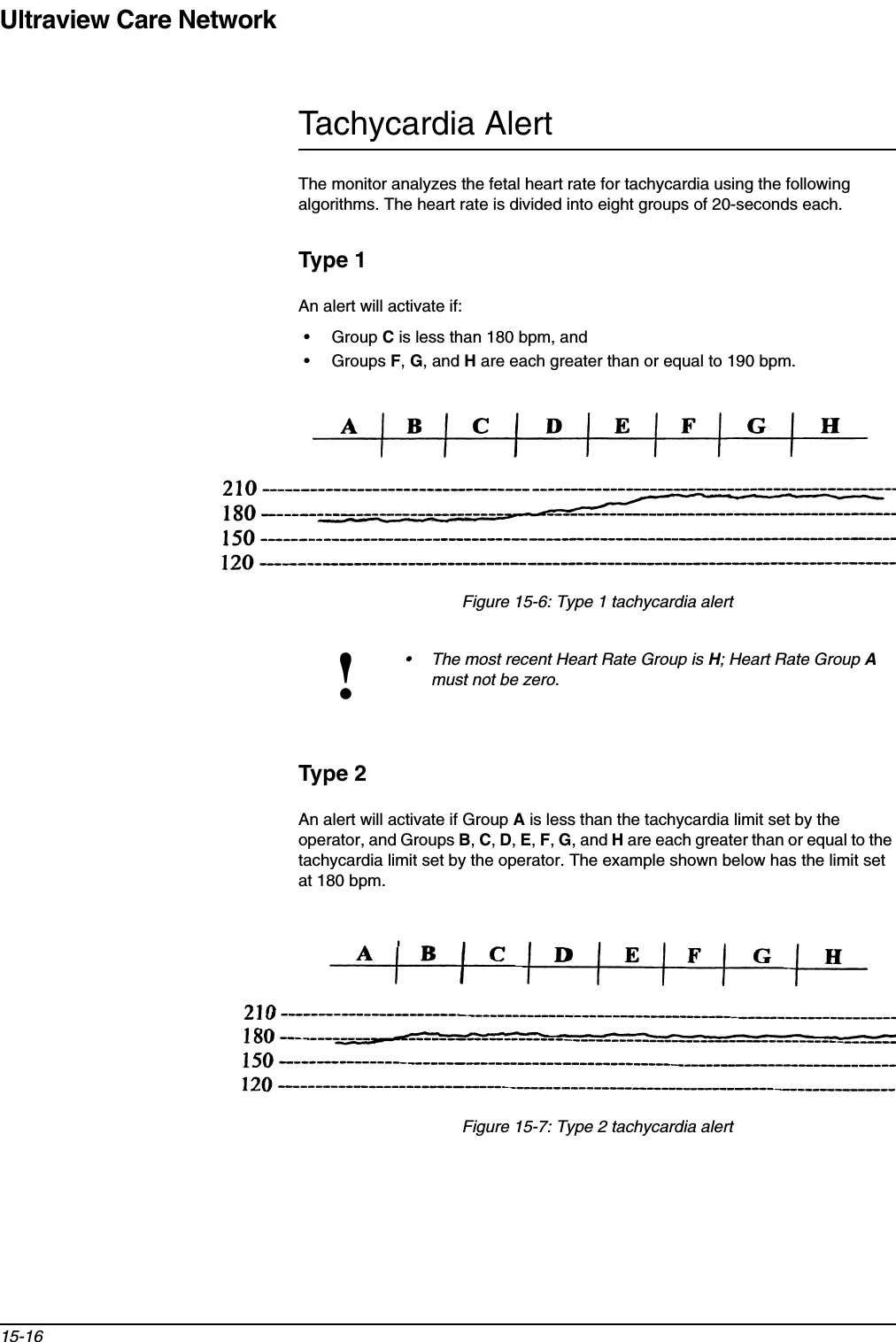 Ultraview Care Network15-16Tachycardia AlertThe monitor analyzes the fetal heart rate for tachycardia using the following algorithms. The heart rate is divided into eight groups of 20-seconds each.Type 1An alert will activate if:•Group Cis less than 180 bpm, and•Groups F,G, and Hare each greater than or equal to 190 bpm.Figure 15-6: Type 1 tachycardia alertType 2An alert will activate if Group Ais less than the tachycardia limit set by the operator, and Groups B,C,D,E,F,G, and Hare each greater than or equal to the tachycardia limit set by the operator. The example shown below has the limit set at 180 bpm. Figure 15-7: Type 2 tachycardia alert!• The most recent Heart Rate Group is H; Heart Rate Group Amust not be zero.