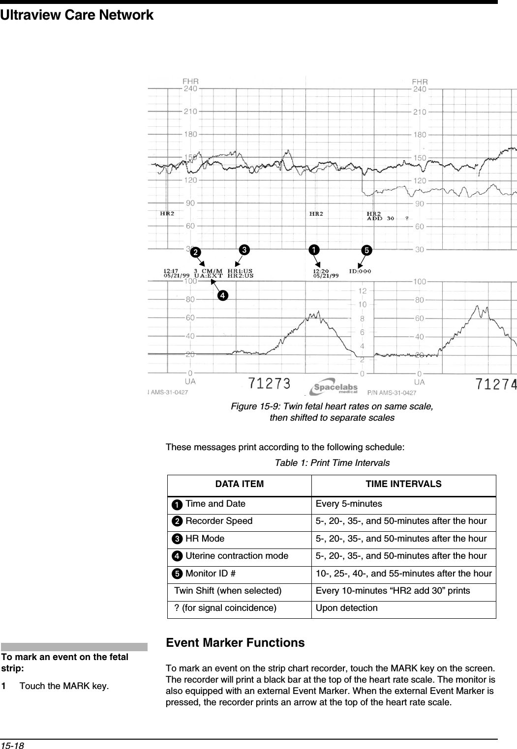 Ultraview Care Network15-18Figure 15-9: Twin fetal heart rates on same scale, then shifted to separate scalesThese messages print according to the following schedule:Event Marker FunctionsTo mark an event on the strip chart recorder, touch the MARK key on the screen. The recorder will print a black bar at the top of the heart rate scale. The monitor is also equipped with an external Event Marker. When the external Event Marker is pressed, the recorder prints an arrow at the top of the heart rate scale.Table 1: Print Time IntervalsDATA ITEM  TIME INTERVALSᕡ Time and Date Every 5-minutesᕢ Recorder Speed 5-, 20-, 35-, and 50-minutes after the hourᕣ HR Mode 5-, 20-, 35-, and 50-minutes after the hourᕤ Uterine contraction mode 5-, 20-, 35-, and 50-minutes after the hourᕥ Monitor ID # 10-, 25-, 40-, and 55-minutes after the hour Twin Shift (when selected) Every 10-minutes “HR2 add 30” prints ? (for signal coincidence) Upon detectionᕢᕣᕡᕤᕥTo mark an event on the fetal strip:1Touch the MARK key.
