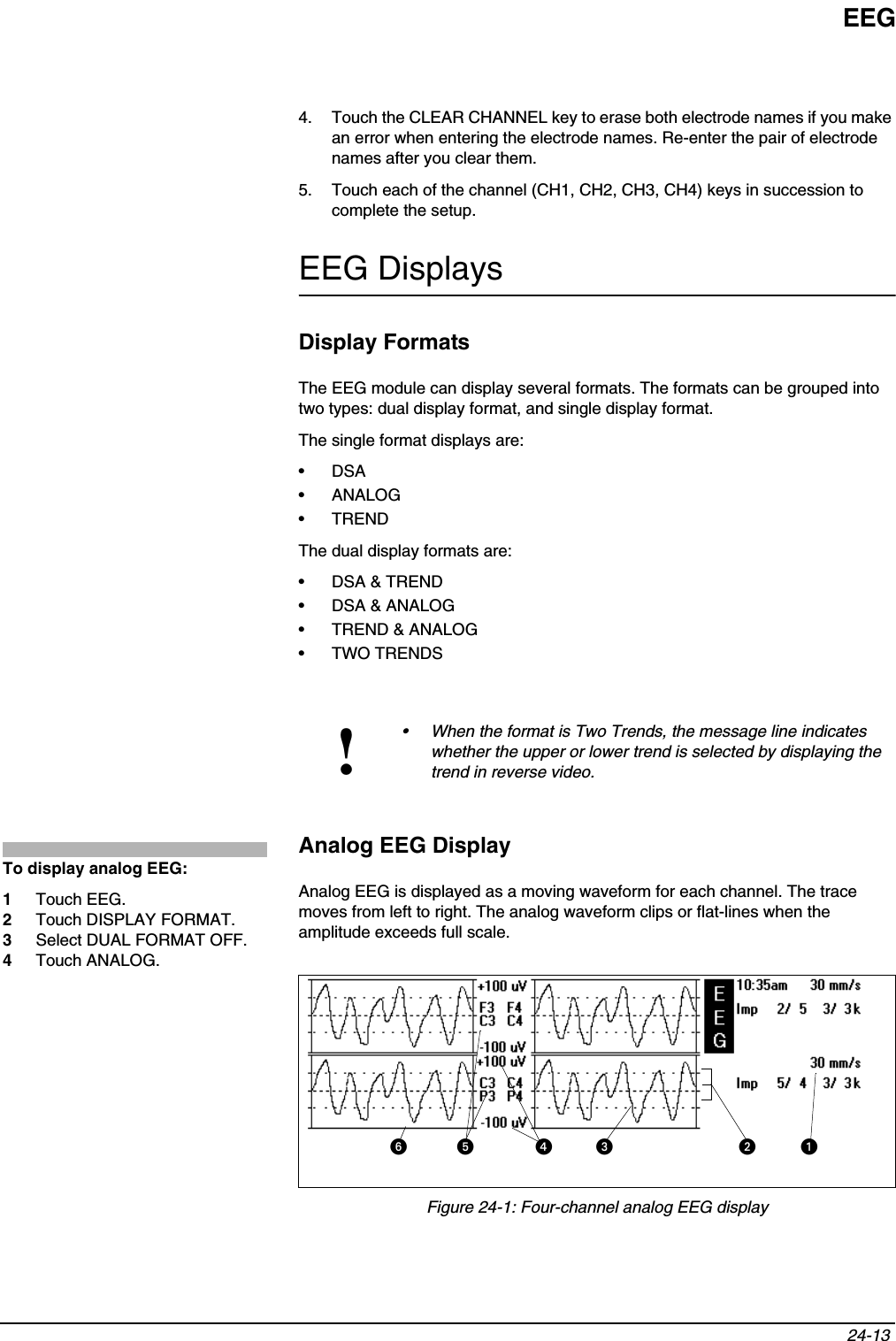 EEG24-13 4. Touch the CLEAR CHANNEL key to erase both electrode names if you make an error when entering the electrode names. Re-enter the pair of electrode names after you clear them.5. Touch each of the channel (CH1, CH2, CH3, CH4) keys in succession to complete the setup.EEG DisplaysDisplay FormatsThe EEG module can display several formats. The formats can be grouped into two types: dual display format, and single display format. The single format displays are:•DSA•ANALOG• TRENDThe dual display formats are:• DSA &amp; TREND• DSA &amp; ANALOG• TREND &amp; ANALOG• TWO TRENDSAnalog EEG DisplayAnalog EEG is displayed as a moving waveform for each channel. The trace moves from left to right. The analog waveform clips or flat-lines when the amplitude exceeds full scale. Figure 24-1: Four-channel analog EEG display!• When the format is Two Trends, the message line indicates whether the upper or lower trend is selected by displaying the trend in reverse video.To display analog EEG:1Touch EEG.2Touch DISPLAY FORMAT.3Select DUAL FORMAT OFF.4Touch ANALOG.