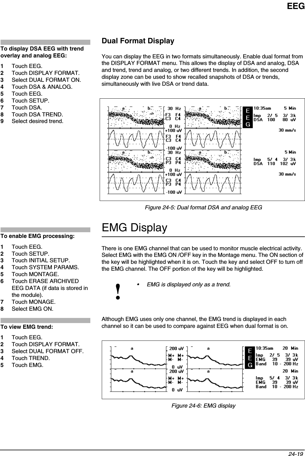 EEG24-19 Dual Format DisplayYou can display the EEG in two formats simultaneously. Enable dual format from the DISPLAY FORMAT menu. This allows the display of DSA and analog, DSA and trend, trend and analog, or two different trends. In addition, the second display zone can be used to show recalled snapshots of DSA or trends, simultaneously with live DSA or trend data.Figure 24-5: Dual format DSA and analog EEGEMG DisplayThere is one EMG channel that can be used to monitor muscle electrical activity. Select EMG with the EMG ON /OFF key in the Montage menu. The ON section of the key will be highlighted when it is on. Touch the key and select OFF to turn off the EMG channel. The OFF portion of the key will be highlighted.Although EMG uses only one channel, the EMG trend is displayed in each channel so it can be used to compare against EEG when dual format is on.Figure 24-6: EMG display!• EMG is displayed only as a trend. To display DSA EEG with trend overlay and analog EEG:1Touch EEG.2Touch DISPLAY FORMAT.3Select DUAL FORMAT ON.4Touch DSA &amp; ANALOG.5Touch EEG.6Touch SETUP.7Touch DSA.8Touch DSA TREND.9Select desired trend.To enable EMG processing:1Touch EEG.2Touch SETUP.3Touch INITIAL SETUP.4Touch SYSTEM PARAMS.5Touch MONTAGE.6Touch ERASE ARCHIVED EEG DATA (if data is stored in the module).7Touch MONAGE.8Select EMG ON.To view EMG trend:1Touch EEG.2Touch DISPLAY FORMAT.3Select DUAL FORMAT OFF.4Touch TREND.5Touch EMG.