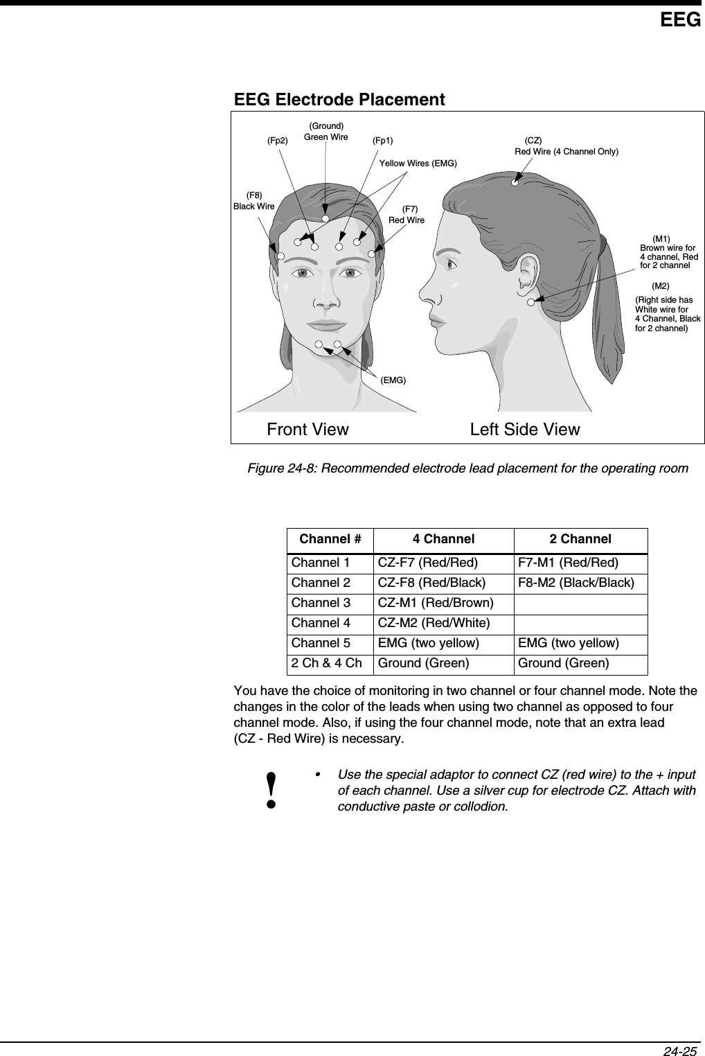 EEG24-25 EEG Electrode PlacementFigure 24-8: Recommended electrode lead placement for the operating roomYou have the choice of monitoring in two channel or four channel mode. Note the changes in the color of the leads when using two channel as opposed to four channel mode. Also, if using the four channel mode, note that an extra lead (CZ - Red Wire) is necessary.Channel # 4 Channel 2 ChannelChannel 1 CZ-F7 (Red/Red) F7-M1 (Red/Red)Channel 2 CZ-F8 (Red/Black) F8-M2 (Black/Black)Channel 3 CZ-M1 (Red/Brown)Channel 4 CZ-M2 (Red/White)Channel 5 EMG (two yellow) EMG (two yellow)2 Ch &amp; 4 Ch Ground (Green) Ground (Green)!• Use the special adaptor to connect CZ (red wire) to the + input of each channel. Use a silver cup for electrode CZ. Attach with conductive paste or collodion.Green Wire(Ground)Red Wire (4 Channel Only)(Right side hasFront View Left Side ViewWhite wire for 4 Channel, Blackfor 2 channel)Brown wire for4 channel, Redfor 2 channel(M1)(M2)(Fp1)(Fp2) (CZ)Yellow Wires (EMG)Black Wire(F8)Red Wire(F7)(EMG)
