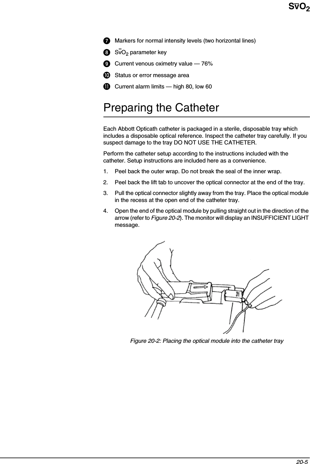 SvO220-5 Markers for normal intensity levels (two horizontal lines)SvO2 parameter keyCurrent venous oximetry value — 76%쐅Status or error message area쐈Current alarm limits — high 80, low 60Preparing the CatheterEach Abbott Opticath catheter is packaged in a sterile, disposable tray which includes a disposable optical reference. Inspect the catheter tray carefully. If you suspect damage to the tray DO NOT USE THE CATHETER.Perform the catheter setup according to the instructions included with the catheter. Setup instructions are included here as a convenience.1. Peel back the outer wrap. Do not break the seal of the inner wrap.2. Peel back the lift tab to uncover the optical connector at the end of the tray.3. Pull the optical connector slightly away from the tray. Place the optical module in the recess at the open end of the catheter tray.4. Open the end of the optical module by pulling straight out in the direction of the arrow (refer to Figure 20-2). The monitor will display an INSUFFICIENT LIGHT message.Figure 20-2: Placing the optical module into the catheter tray