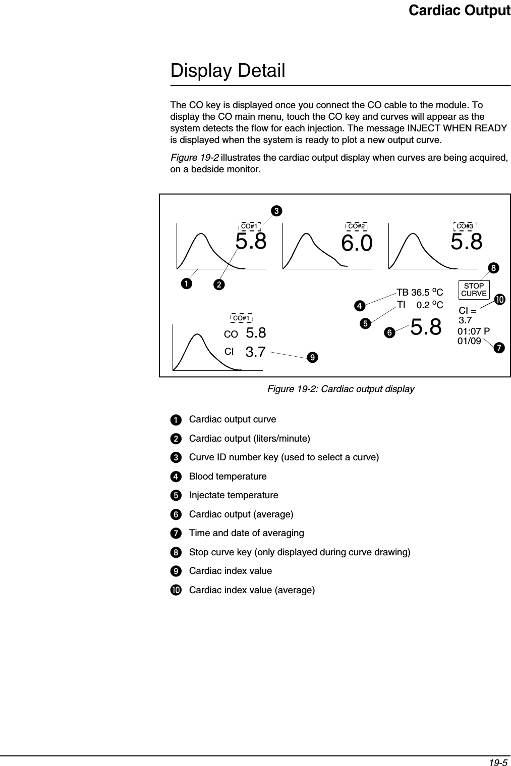 Cardiac Output19-5 Display DetailThe CO key is displayed once you connect the CO cable to the module. To display the CO main menu, touch the CO key and curves will appear as the system detects the flow for each injection. The message INJECT WHEN READY is displayed when the system is ready to plot a new output curve.Figure 19-2 illustrates the cardiac output display when curves are being acquired, on a bedside monitor.Figure 19-2: Cardiac output displayCardiac output curveCardiac output (liters/minute)Curve ID number key (used to select a curve)Blood temperatureInjectate temperatureCardiac output (average)Time and date of averagingStop curve key (only displayed during curve drawing)Cardiac index value쐅Cardiac index value (average)CO#1 CO#2 CO#35.8 5.86.0TB 36.5 oCTI5.80.2 oC01:07 P01/09STOPCURVECO#15.8COCI 3.7CI = 3.7쐅