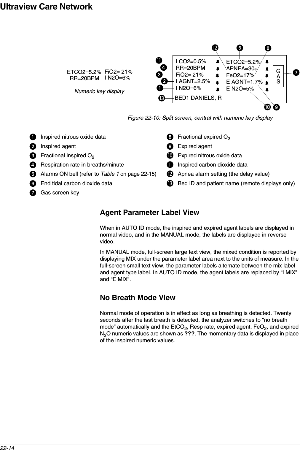 Ultraview Care Network22-14Figure 22-10: Split screen, central with numeric key display Agent Parameter Label ViewWhen in AUTO ID mode, the inspired and expired agent labels are displayed in normal video, and in the MANUAL mode, the labels are displayed in reverse video.In MANUAL mode, full-screen large text view, the mixed condition is reported by displaying MIX under the parameter label area next to the units of measure. In the full-screen small text view, the parameter labels alternate between the mix label and agent type label. In AUTO ID mode, the agent labels are replaced by “I MIX” and “E MIX”.No Breath Mode ViewNormal mode of operation is in effect as long as breathing is detected. Twenty seconds after the last breath is detected, the analyzer switches to “no breath mode” automatically and the EtCO2, Resp rate, expired agent, FeO2, and expired N2O numeric values are shown as ???. The momentary data is displayed in place of the inspired numeric values.Inspired nitrous oxide data Fractional expired O2Inspired agent Expired agentFractional inspired O2쐅Expired nitrous oxide dataRespiration rate in breaths/minute 쐈Inspired carbon dioxide dataAlarms ON bell (refer to Table 1 on page 22-15) 쐉Apnea alarm setting (the delay value)End tidal carbon dioxide data 씈Bed ID and patient name (remote displays only)Gas screen keyGASBED1 DANIELS, RI CO2=0.5%RR=20BPMFiO2= 21%I AGNT=2.5%I N2O=6% ETCO2=5.2% APNEA=30sFeO2=17% E AGNT=1.7% E N2O=5%RR=20BPMFiO2= 21%I N2O=6% ETCO2=5.2% Numeric key display쐈쐉씈쐅