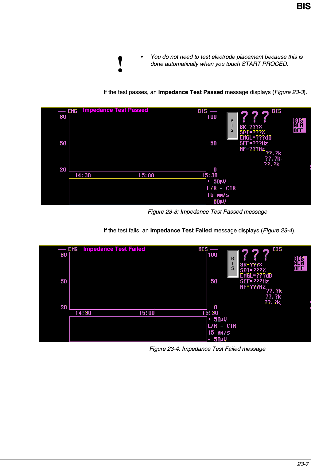 BIS23-7 If the test passes, an Impedance Test Passed message displays (Figure 23-3).Figure 23-3: Impedance Test Passed messageIf the test fails, an Impedance Test Failed message displays (Figure 23-4).Figure 23-4: Impedance Test Failed message!• You do not need to test electrode placement because this is done automatically when you touch START PROCED.Impedance Test PassedImpedance Test FailedImpedance Test PassedImpedance Test PassedImpedance Test Failed