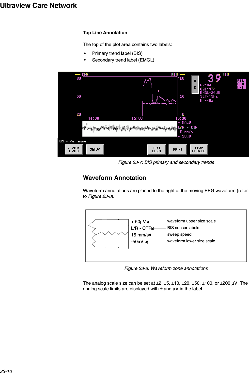 Ultraview Care Network23-10Top Line AnnotationThe top of the plot area contains two labels: • Primary trend label (BIS) • Secondary trend label (EMGL)Figure 23-7: BIS primary and secondary trendsWaveform AnnotationWaveform annotations are placed to the right of the moving EEG waveform (refer to Figure 23-8).Figure 23-8: Waveform zone annotationsThe analog scale size can be set at ±2, ±5, ±10, ±20, ±50, ±100, or ±200 µV. The analog scale limits are displayed with ± and µV in the label.+ 50µVL/R - CTR15 mm/s-50µVwaveform upper size scaleBIS sensor labelssweep speedwaveform lower size scale