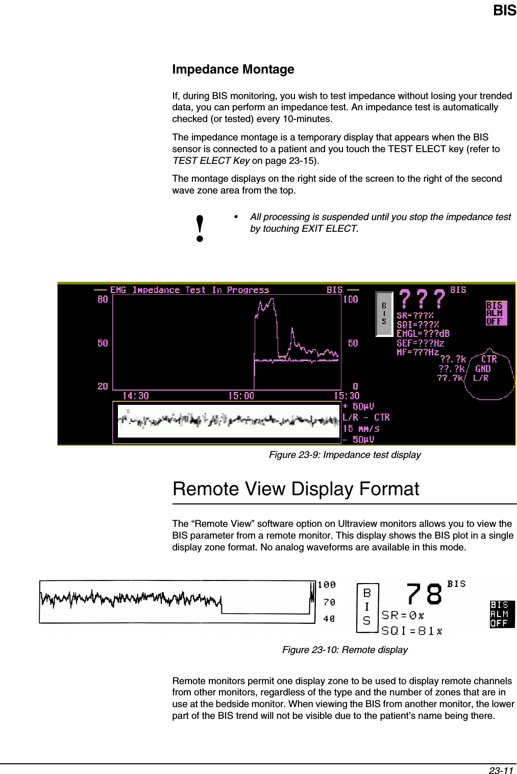 BIS23-11 Impedance MontageIf, during BIS monitoring, you wish to test impedance without losing your trended data, you can perform an impedance test. An impedance test is automatically checked (or tested) every 10-minutes.The impedance montage is a temporary display that appears when the BIS sensor is connected to a patient and you touch the TEST ELECT key (refer to TEST ELECT Key on page 23-15). The montage displays on the right side of the screen to the right of the second wave zone area from the top. Figure 23-9: Impedance test displayRemote View Display FormatThe “Remote View” software option on Ultraview monitors allows you to view the BIS parameter from a remote monitor. This display shows the BIS plot in a single display zone format. No analog waveforms are available in this mode.Figure 23-10: Remote displayRemote monitors permit one display zone to be used to display remote channels from other monitors, regardless of the type and the number of zones that are in use at the bedside monitor. When viewing the BIS from another monitor, the lower part of the BIS trend will not be visible due to the patient’s name being there. !• All processing is suspended until you stop the impedance test by touching EXIT ELECT.