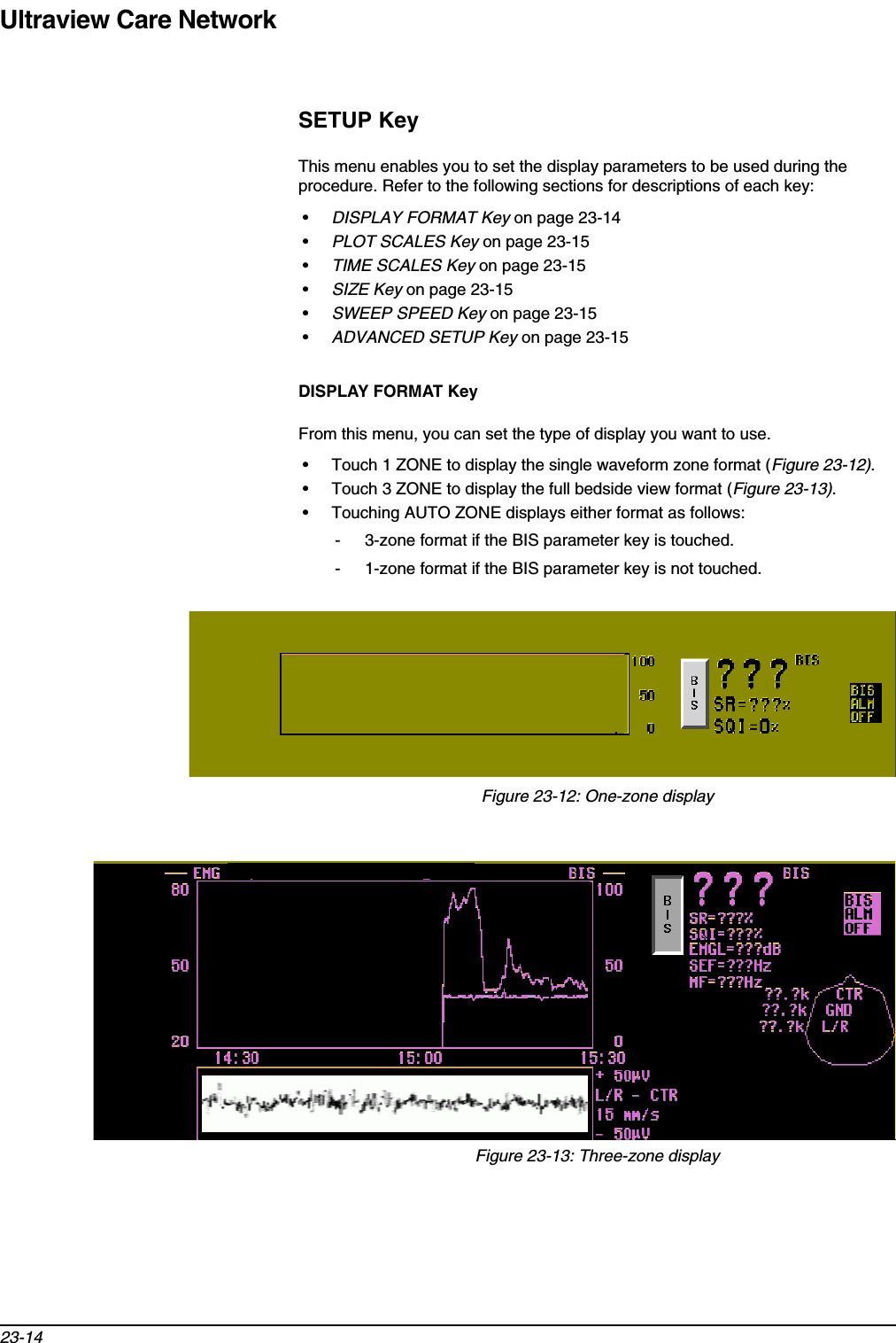 Ultraview Care Network23-14SETUP KeyThis menu enables you to set the display parameters to be used during the procedure. Refer to the following sections for descriptions of each key:•DISPLAY FORMAT Key on page 23-14•PLOT SCALES Key on page 23-15•TIME SCALES Key on page 23-15•SIZE Key on page 23-15•SWEEP SPEED Key on page 23-15•ADVANCED SETUP Key on page 23-15DISPLAY FORMAT KeyFrom this menu, you can set the type of display you want to use. • Touch 1 ZONE to display the single waveform zone format (Figure 23-12).• Touch 3 ZONE to display the full bedside view format (Figure 23-13).• Touching AUTO ZONE displays either format as follows:- 3-zone format if the BIS parameter key is touched.- 1-zone format if the BIS parameter key is not touched.Figure 23-12: One-zone displayFigure 23-13: Three-zone display