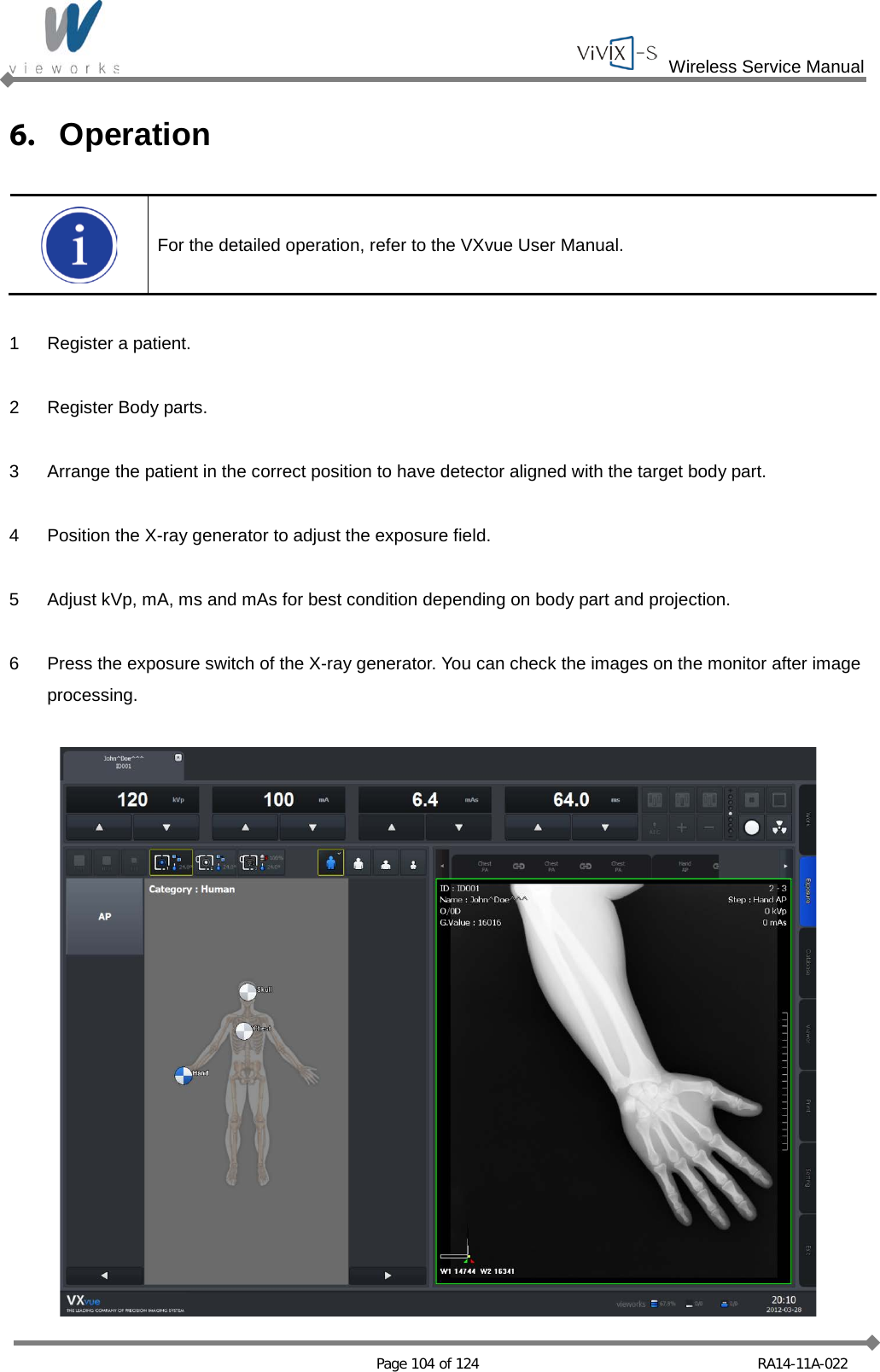  Wireless Service Manual   Page 104 of 124 RA14-11A-022 6. Operation   For the detailed operation, refer to the VXvue User Manual.  1  Register a patient.  2  Register Body parts.  3  Arrange the patient in the correct position to have detector aligned with the target body part.  4  Position the X-ray generator to adjust the exposure field.  5  Adjust kVp, mA, ms and mAs for best condition depending on body part and projection.  6  Press the exposure switch of the X-ray generator. You can check the images on the monitor after image processing.    