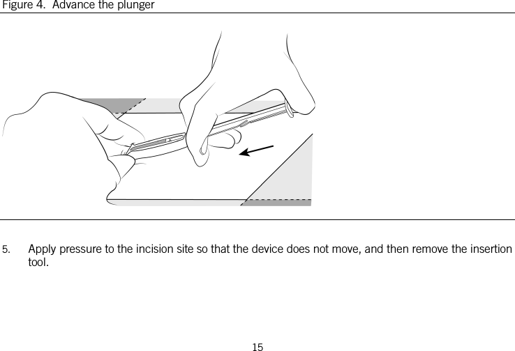  Figure 4.  Advance the plunger   5. Apply pressure to the incision site so that the device does not move, and then remove the insertion tool. 15   