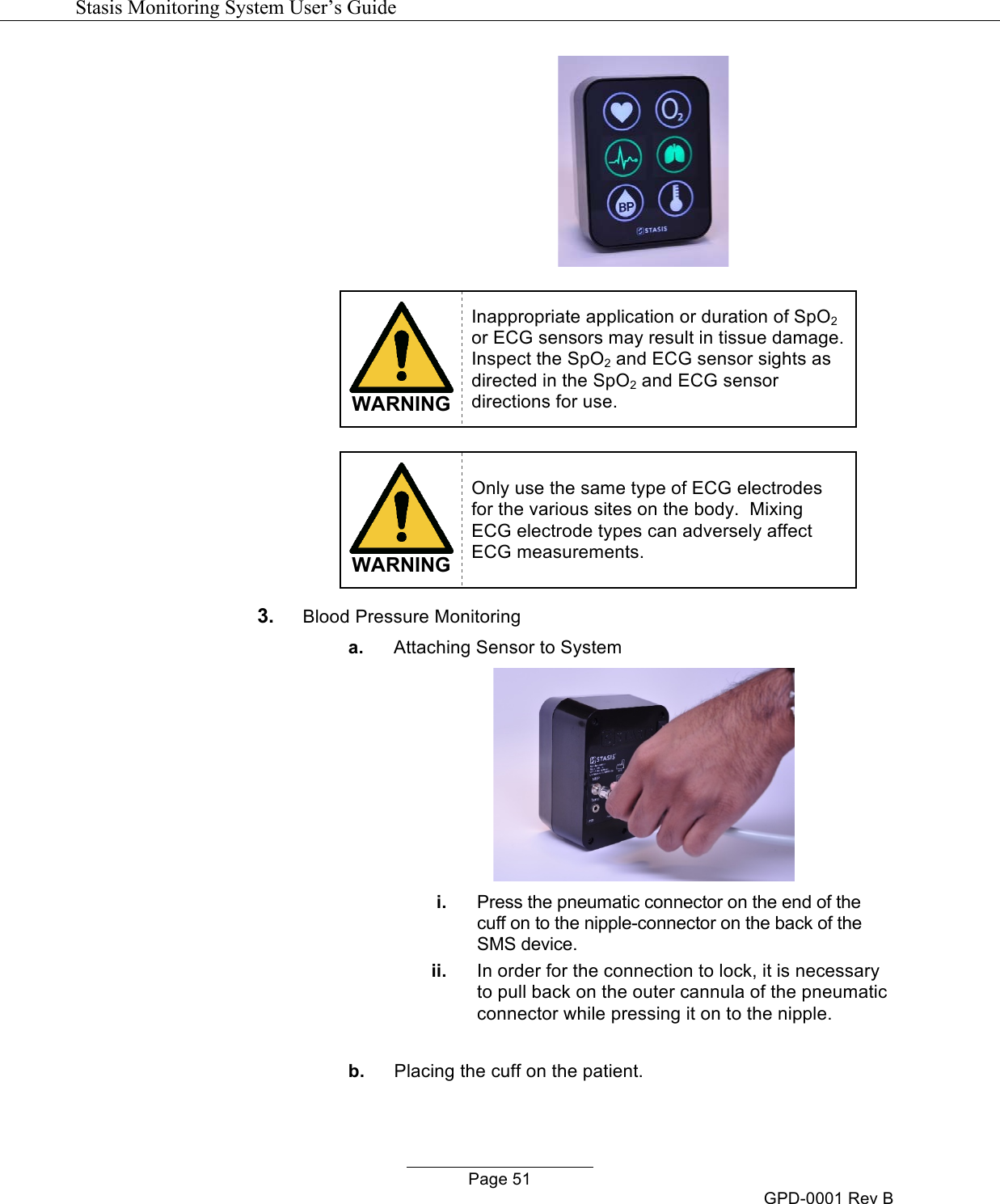   Stasis Monitoring System User&rsquo;s Guide   Page 51 GPD-0001 Rev B    WARNING Inappropriate application or duration of SpO2 or ECG sensors may result in tissue damage.  Inspect the SpO2 and ECG sensor sights as directed in the SpO2 and ECG sensor directions for use.   WARNING Only use the same type of ECG electrodes for the various sites on the body.  Mixing ECG electrode types can adversely affect ECG measurements. 3. Blood Pressure Monitoring a. Attaching Sensor to System  i. Press the pneumatic connector on the end of the cuff on to the nipple-connector on the back of the SMS device.  ii. In order for the connection to lock, it is necessary to pull back on the outer cannula of the pneumatic connector while pressing it on to the nipple.  b. Placing the cuff on the patient. 