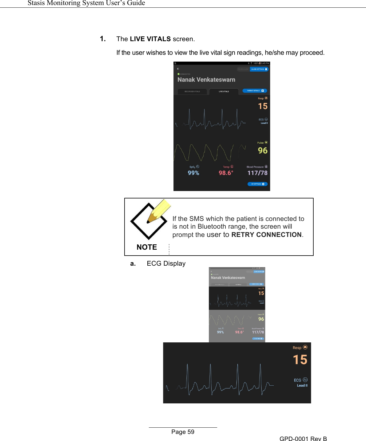  Stasis Monitoring System User&rsquo;s Guide   Page 59 GPD-0001 Rev B  1. The LIVE VITALS screen. If the user wishes to view the live vital sign readings, he/she may proceed.    NOTE If the SMS which the patient is connected to is not in Bluetooth range, the screen will prompt the user to RETRY CONNECTION. a. ECG Display   
