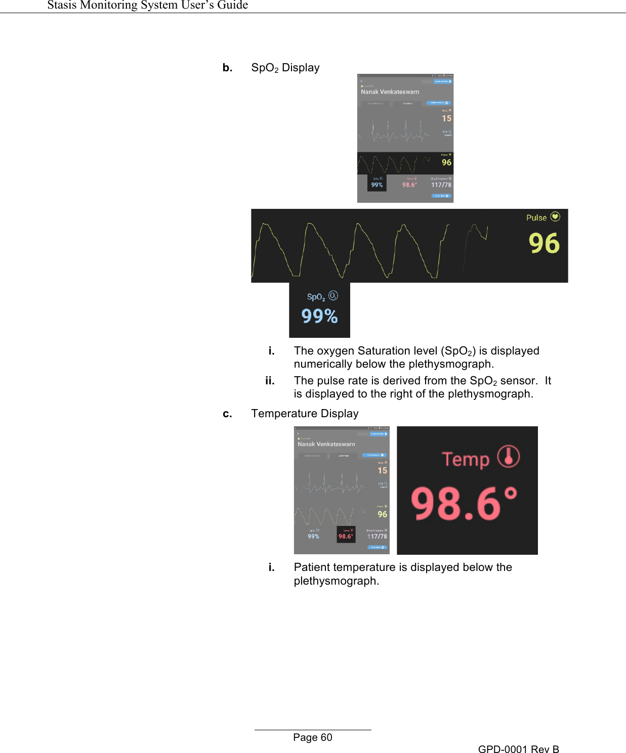   Stasis Monitoring System User&rsquo;s Guide   Page 60 GPD-0001 Rev B  b. SpO2 Display    i. The oxygen Saturation level (SpO2) is displayed numerically below the plethysmograph.  ii. The pulse rate is derived from the SpO2 sensor.  It is displayed to the right of the plethysmograph.   c. Temperature Display     i. Patient temperature is displayed below the plethysmograph. 