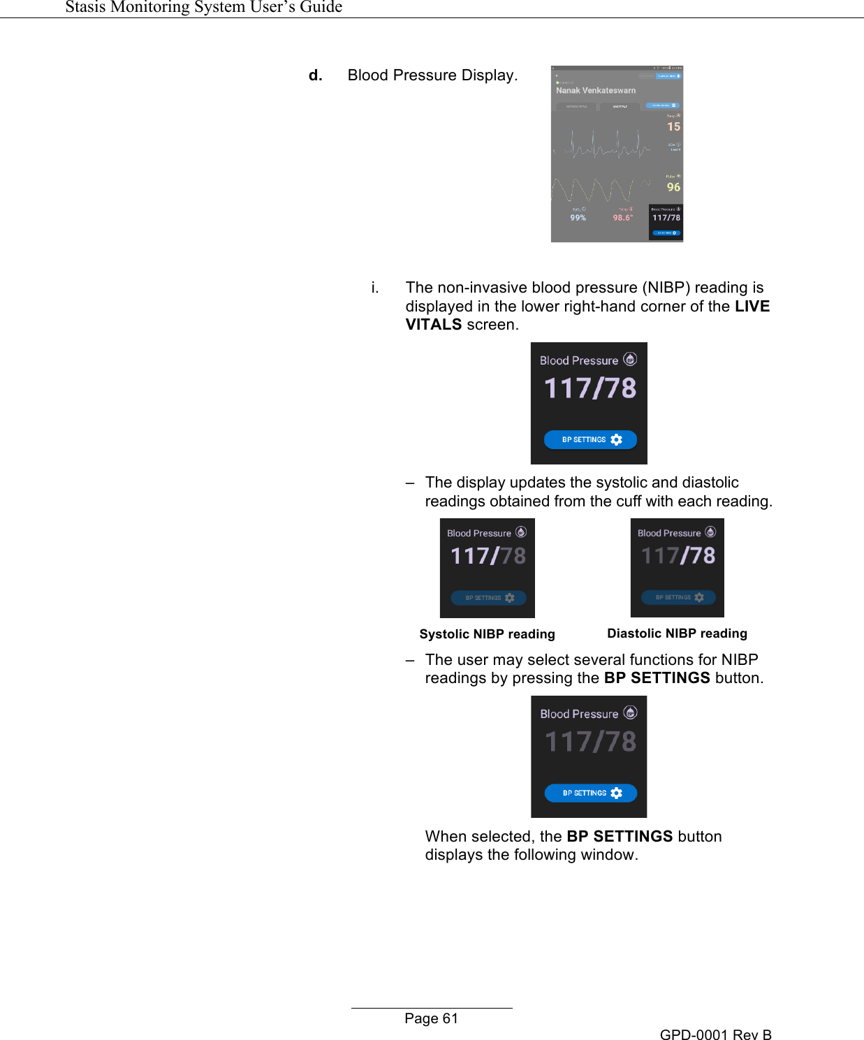   Stasis Monitoring System User&rsquo;s Guide   Page 61 GPD-0001 Rev B d. Blood Pressure Display.   i. The non-invasive blood pressure (NIBP) reading is displayed in the lower right-hand corner of the LIVE VITALS screen.   &ndash;   The display updates the systolic and diastolic readings obtained from the cuff with each reading.    Systolic NIBP reading  Diastolic NIBP reading &ndash;   The user may select several functions for NIBP readings by pressing the BP SETTINGS button.    When selected, the BP SETTINGS button displays the following window.   