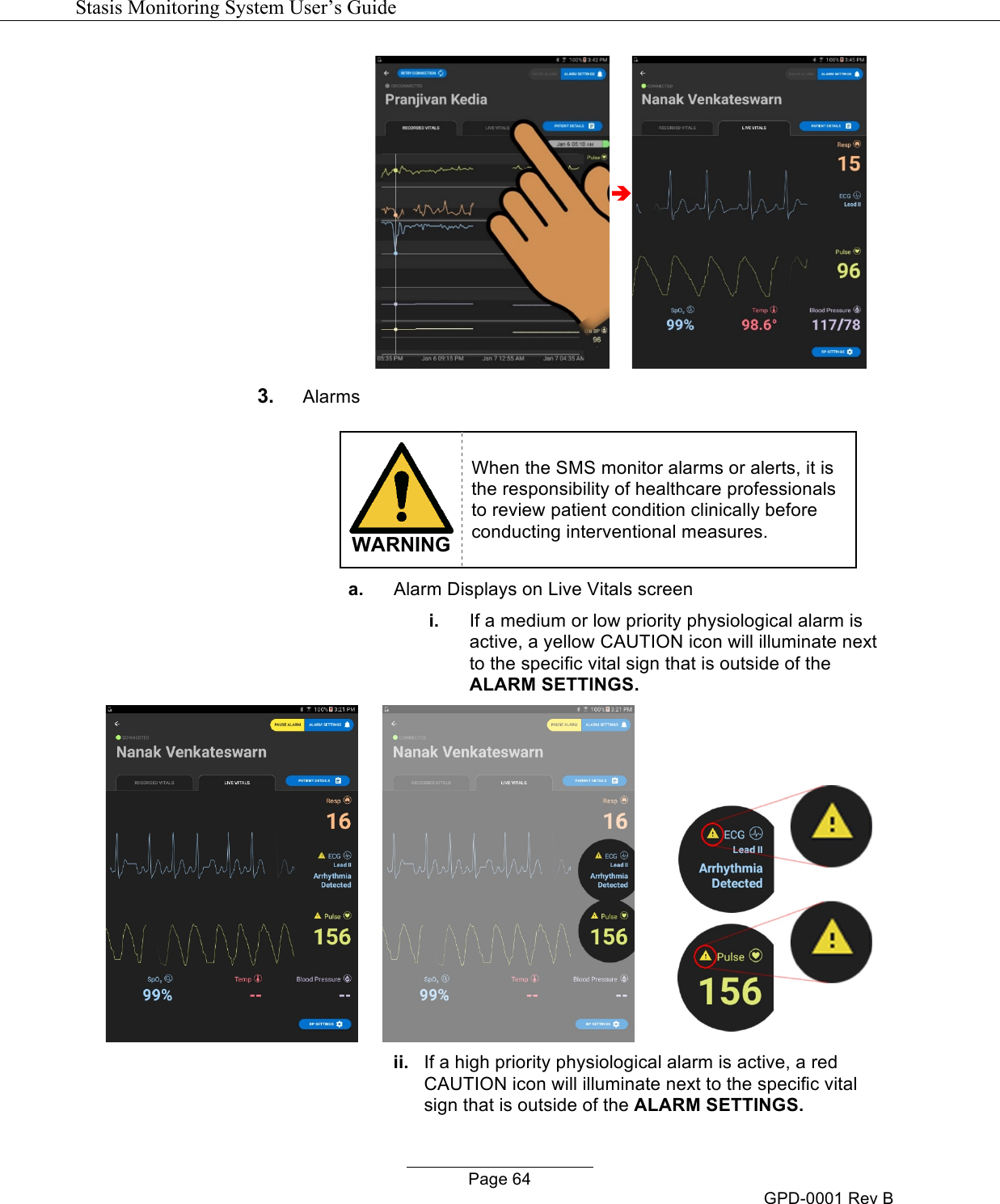   Stasis Monitoring System User&rsquo;s Guide   Page 64 GPD-0001 Rev B &egrave; 3. Alarms    WARNING When the SMS monitor alarms or alerts, it is the responsibility of healthcare professionals to review patient condition clinically before conducting interventional measures. a. Alarm Displays on Live Vitals screen i. If a medium or low priority physiological alarm is active, a yellow CAUTION icon will illuminate next to the specific vital sign that is outside of the ALARM SETTINGS.  ii. If a high priority physiological alarm is active, a red CAUTION icon will illuminate next to the specific vital sign that is outside of the ALARM SETTINGS. 