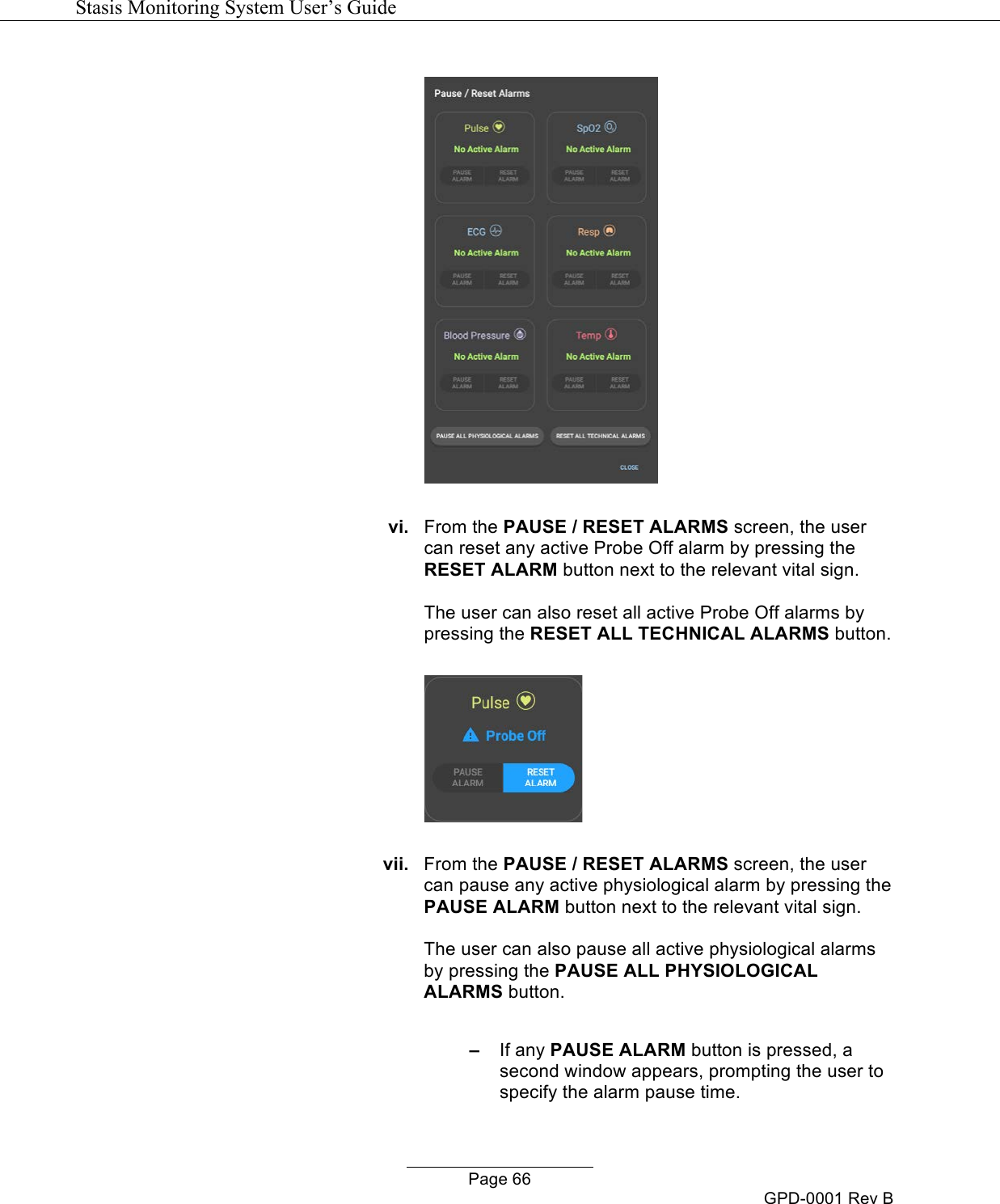   Stasis Monitoring System User&rsquo;s Guide   Page 66 GPD-0001 Rev B    vi. From the PAUSE / RESET ALARMS screen, the user can reset any active Probe Off alarm by pressing the RESET ALARM button next to the relevant vital sign.  The user can also reset all active Probe Off alarms by pressing the RESET ALL TECHNICAL ALARMS button.    vii. From the PAUSE / RESET ALARMS screen, the user can pause any active physiological alarm by pressing the PAUSE ALARM button next to the relevant vital sign.  The user can also pause all active physiological alarms by pressing the PAUSE ALL PHYSIOLOGICAL ALARMS button.  &ndash;   If any PAUSE ALARM button is pressed, a second window appears, prompting the user to specify the alarm pause time.   