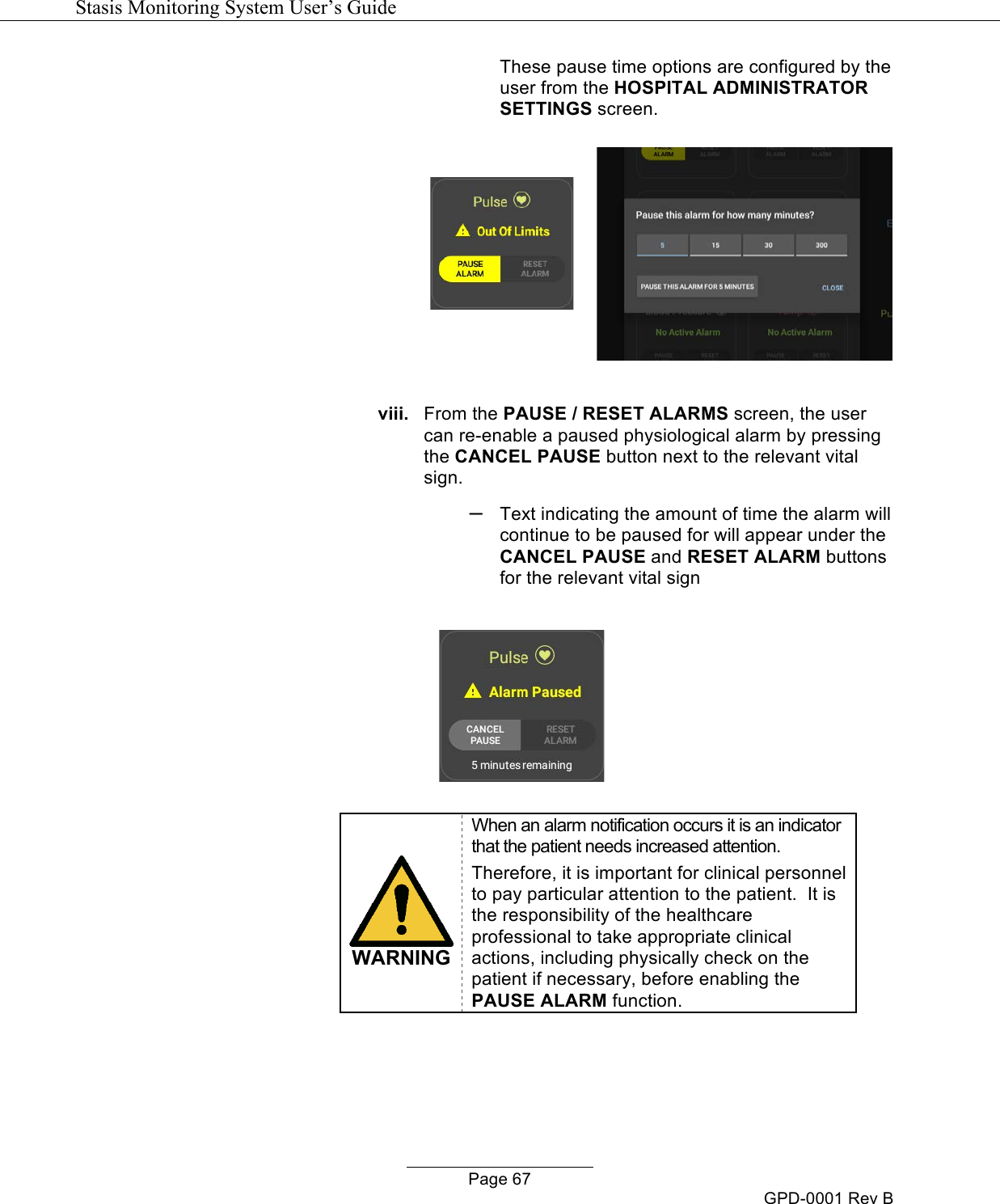   Stasis Monitoring System User&rsquo;s Guide   Page 67 GPD-0001 Rev B These pause time options are configured by the user from the HOSPITAL ADMINISTRATOR SETTINGS screen.     viii. From the PAUSE / RESET ALARMS screen, the user can re-enable a paused physiological alarm by pressing the CANCEL PAUSE button next to the relevant vital sign. &ndash;  Text indicating the amount of time the alarm will continue to be paused for will appear under the CANCEL PAUSE and RESET ALARM buttons for the relevant vital sign      WARNING When an alarm notification occurs it is an indicator that the patient needs increased attention. Therefore, it is important for clinical personnel to pay particular attention to the patient.  It is the responsibility of the healthcare professional to take appropriate clinical actions, including physically check on the patient if necessary, before enabling the PAUSE ALARM function.   
