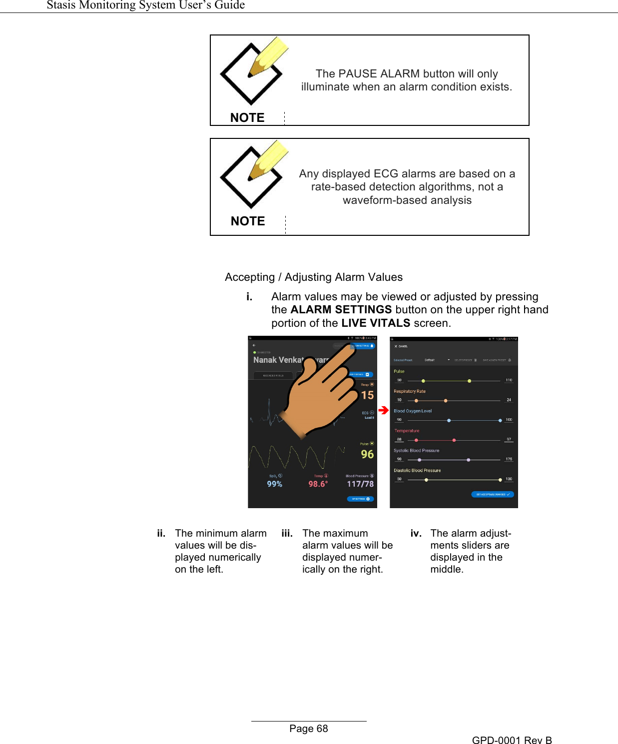   Stasis Monitoring System User&rsquo;s Guide   Page 68 GPD-0001 Rev B  NOTE The PAUSE ALARM button will only illuminate when an alarm condition exists.   NOTE Any displayed ECG alarms are based on a rate-based detection algorithms, not a waveform-based analysis  Accepting / Adjusting Alarm Values i. Alarm values may be viewed or adjusted by pressing the ALARM SETTINGS button on the upper right hand portion of the LIVE VITALS screen.  &egrave;  ii. The minimum alarm values will be dis-played numerically on the left. iii. The maximum alarm values will be displayed numer-ically on the right. iv. The alarm adjust-ments sliders are displayed in the middle. 