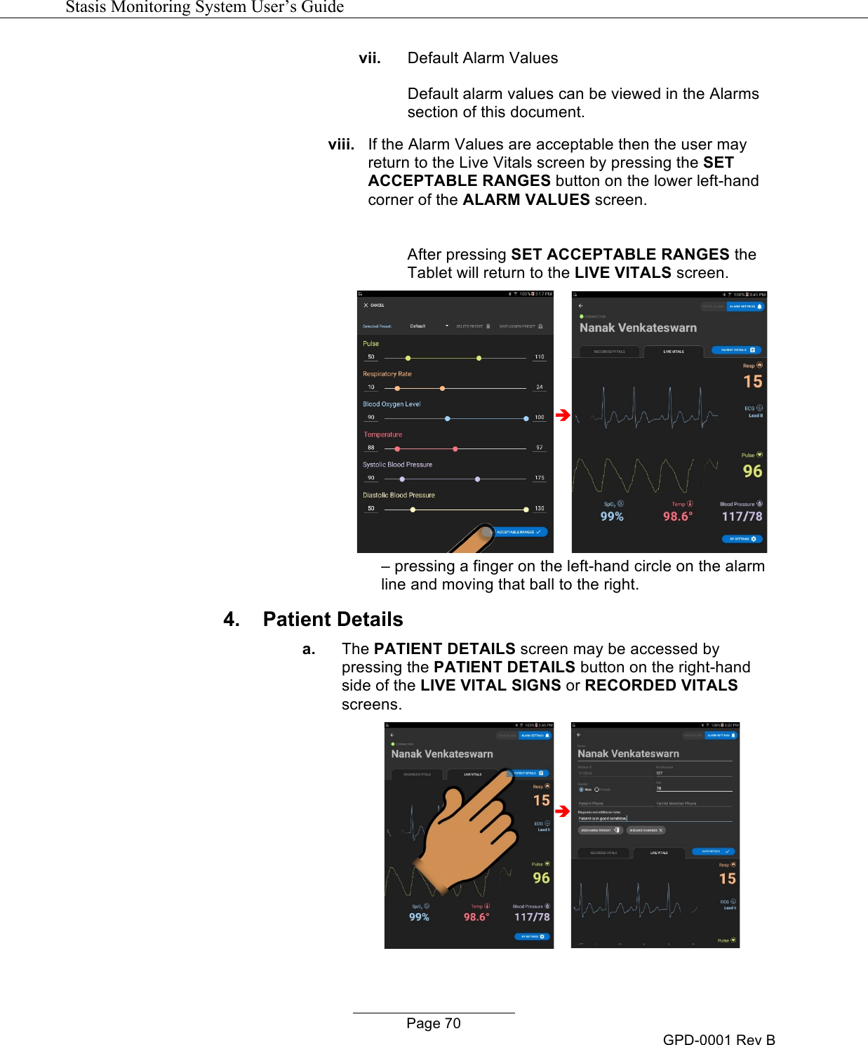   Stasis Monitoring System User&rsquo;s Guide   Page 70 GPD-0001 Rev B vii. Default Alarm Values  Default alarm values can be viewed in the Alarms section of this document. viii. If the Alarm Values are acceptable then the user may return to the Live Vitals screen by pressing the SET ACCEPTABLE RANGES button on the lower left-hand corner of the ALARM VALUES screen.  After pressing SET ACCEPTABLE RANGES the Tablet will return to the LIVE VITALS screen. &egrave; &ndash; pressing a finger on the left-hand circle on the alarm line and moving that ball to the right. 4. Patient Details  a. The PATIENT DETAILS screen may be accessed by pressing the PATIENT DETAILS button on the right-hand side of the LIVE VITAL SIGNS or RECORDED VITALS screens. &egrave;  