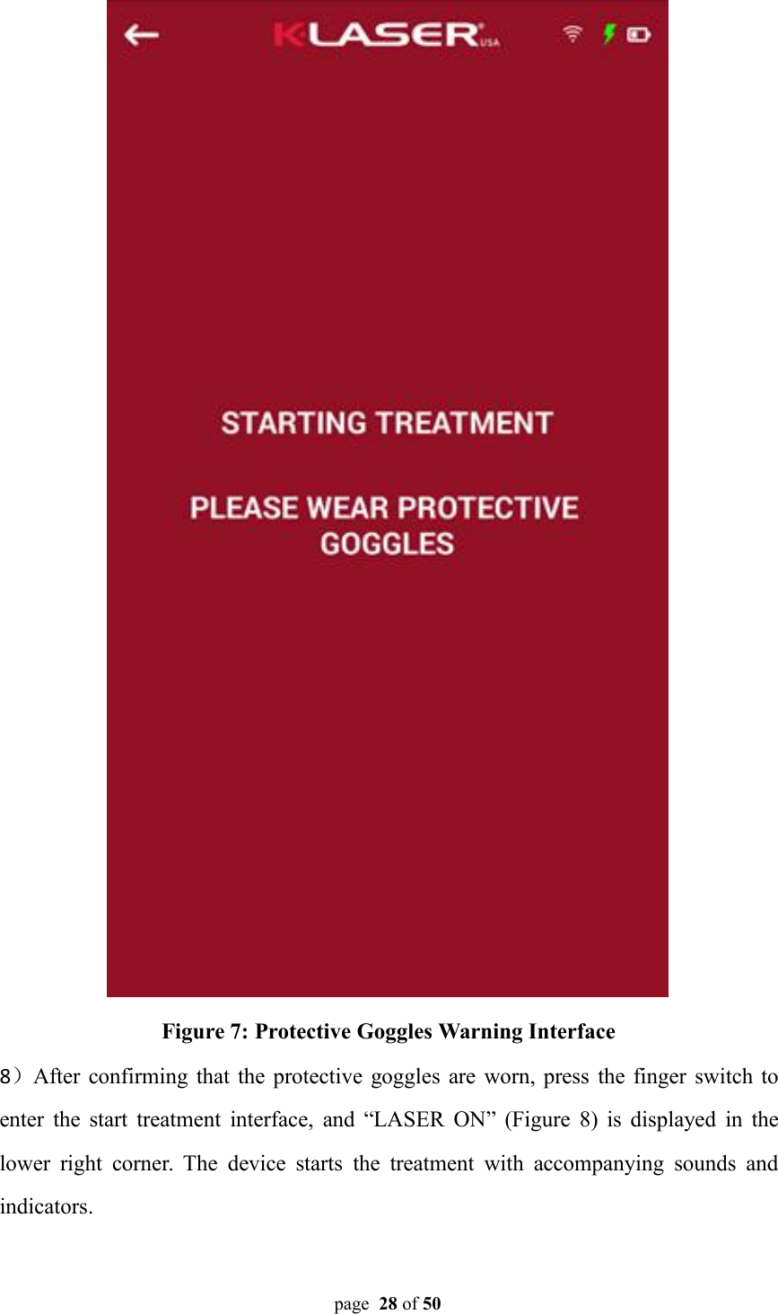 page 28 of 50Figure 7: Protective Goggles Warning Interface8）After confirming that the protective goggles are worn, press the finger switch toenter the start treatment interface, and “LASER ON” (Figure 8) is displayed in thelower right corner. The device starts the treatment with accompanying sounds andindicators.