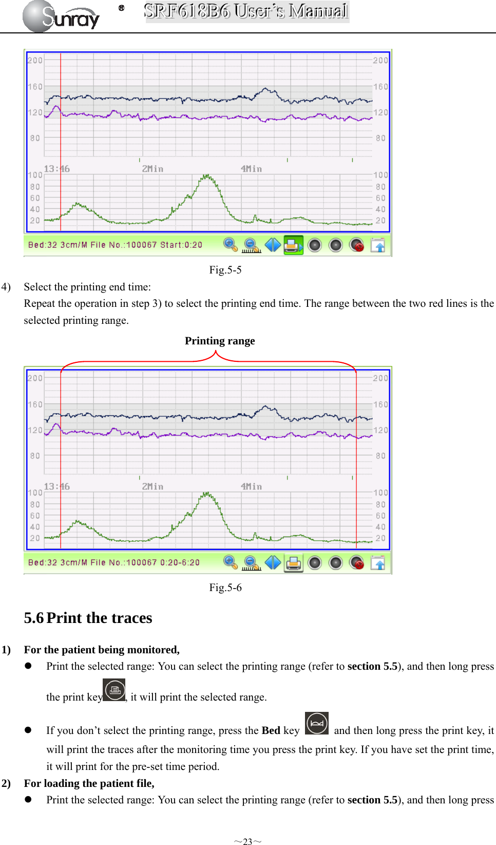 SSSRRRFFF666111888BBB666   UUUssseeerrr’’’sss   MMMaaannnuuuaaalll  ～23～  Fig.5-5 4) Select the printing end time:   Repeat the operation in step 3) to select the printing end time. The range between the two red lines is the selected printing range.    Fig.5-6 5.6 Print the traces 1) For the patient being monitored,    Print the selected range: You can select the printing range (refer to section 5.5), and then long press the print key , it will print the selected range.  If you don’t select the printing range, press the Bed key    and then long press the print key, it will print the traces after the monitoring time you press the print key. If you have set the print time, it will print for the pre-set time period. 2) For loading the patient file,  Print the selected range: You can select the printing range (refer to section 5.5), and then long press Printing range 