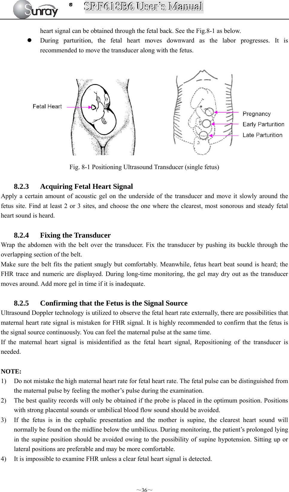 SSSRRRFFF666111888BBB666   UUUssseeerrr’’’sss   MMMaaannnuuuaaalll  ～36～ heart signal can be obtained through the fetal back. See the Fig.8-1 as below.  During parturition, the fetal heart moves downward as the labor progresses. It is recommended to move the transducer along with the fetus.   Fig. 8-1 Positioning Ultrasound Transducer (single fetus)  8.2.3 Acquiring Fetal Heart Signal Apply a certain amount of acoustic gel on the underside of the transducer and move it slowly around the fetus site. Find at least 2 or 3 sites, and choose the one where the clearest, most sonorous and steady fetal heart sound is heard.  8.2.4 Fixing the Transducer Wrap the abdomen with the belt over the transducer. Fix the transducer by pushing its buckle through the overlapping section of the belt. Make sure the belt fits the patient snugly but comfortably. Meanwhile, fetus heart beat sound is heard; the FHR trace and numeric are displayed. During long-time monitoring, the gel may dry out as the transducer moves around. Add more gel in time if it is inadequate.  8.2.5 Confirming that the Fetus is the Signal Source Ultrasound Doppler technology is utilized to observe the fetal heart rate externally, there are possibilities that maternal heart rate signal is mistaken for FHR signal. It is highly recommended to confirm that the fetus is the signal source continuously. You can feel the maternal pulse at the same time. If the maternal heart signal is misidentified as the fetal heart signal, Repositioning of the transducer is needed.  NOTE: 1) Do not mistake the high maternal heart rate for fetal heart rate. The fetal pulse can be distinguished from the maternal pulse by feeling the mother’s pulse during the examination. 2) The best quality records will only be obtained if the probe is placed in the optimum position. Positions with strong placental sounds or umbilical blood flow sound should be avoided. 3) If the fetus is in the cephalic presentation and the mother is supine, the clearest heart sound will normally be found on the midline below the umbilicus. During monitoring, the patient’s prolonged lying in the supine position should be avoided owing to the possibility of supine hypotension. Sitting up or lateral positions are preferable and may be more comfortable. 4) It is impossible to examine FHR unless a clear fetal heart signal is detected.  