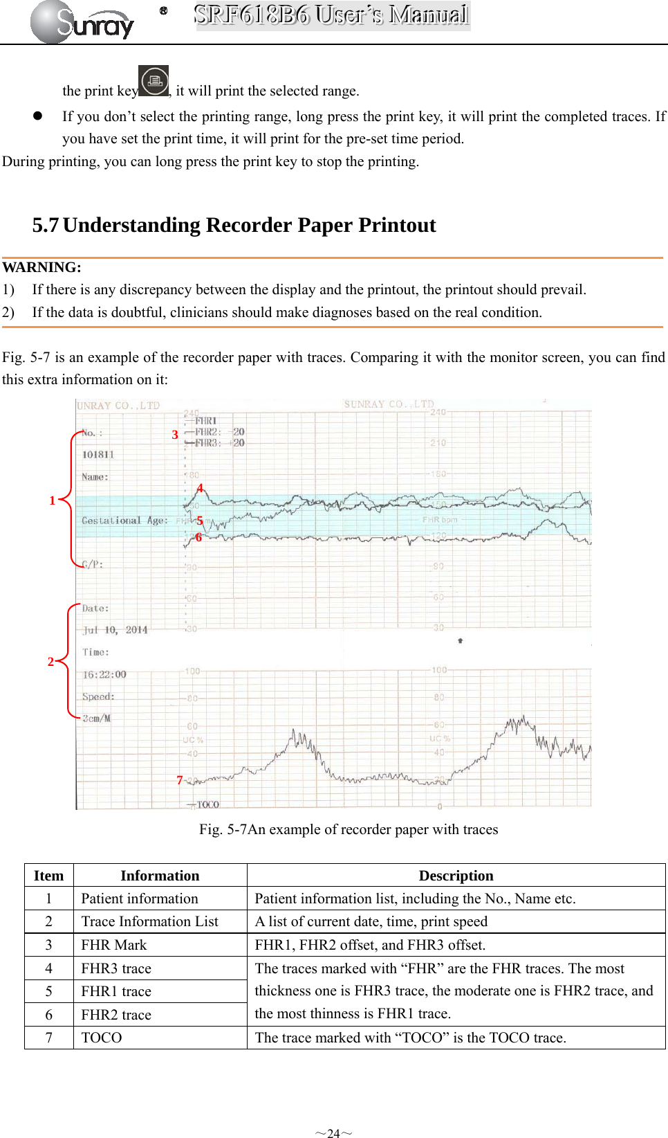 SSSRRRFFF666111888BBB666   UUUssseeerrr’’’sss   MMMaaannnuuuaaalll  ～24～ the print key , it will print the selected range.  If you don’t select the printing range, long press the print key, it will print the completed traces. If you have set the print time, it will print for the pre-set time period. During printing, you can long press the print key to stop the printing.  5.7 Understanding Recorder Paper Printout   WARNING: 1) If there is any discrepancy between the display and the printout, the printout should prevail. 2) If the data is doubtful, clinicians should make diagnoses based on the real condition.    Fig. 5-7 is an example of the recorder paper with traces. Comparing it with the monitor screen, you can find this extra information on it:  Fig. 5-7An example of recorder paper with traces  Item Information  Description 1  Patient information  Patient information list, including the No., Name etc. 2  Trace Information List  A list of current date, time, print speed 3  FHR Mark  FHR1, FHR2 offset, and FHR3 offset. 4  FHR3 trace  The traces marked with “FHR” are the FHR traces. The most thickness one is FHR3 trace, the moderate one is FHR2 trace, and the most thinness is FHR1 trace. 5 FHR1 trace 6 FHR2 trace 7 TOCO  The trace marked with “TOCO” is the TOCO trace.  1 2 3 4 5 6 7 