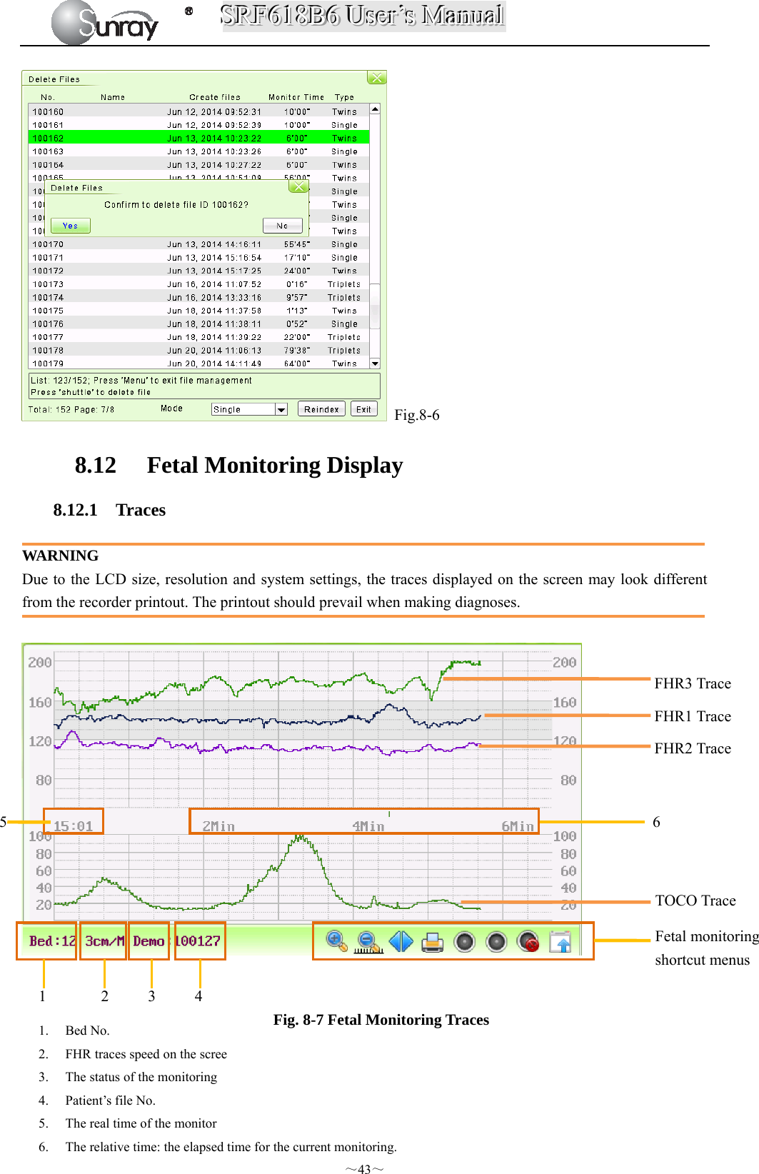 SSSRRRFFF666111888BBB666   UUUssseeerrr’’’sss   MMMaaannnuuuaaalll  ～43～  Fig.8-6 8.12 Fetal Monitoring Display 8.12.1 Traces  WARNING Due to the LCD size, resolution and system settings, the traces displayed on the screen may look different from the recorder printout. The printout should prevail when making diagnoses.     Fig. 8-7 Fetal Monitoring Traces      FHR3 Trace FHR1 Trace FHR2 Trace TOCO Trace Fetal monitoring shortcut menus 1       2     3     4      1. Bed No. 2. FHR traces speed on the scree   3. The status of the monitoring 4. Patient’s file No. 5. The real time of the monitor 6. The relative time: the elapsed time for the current monitoring. 6    5  