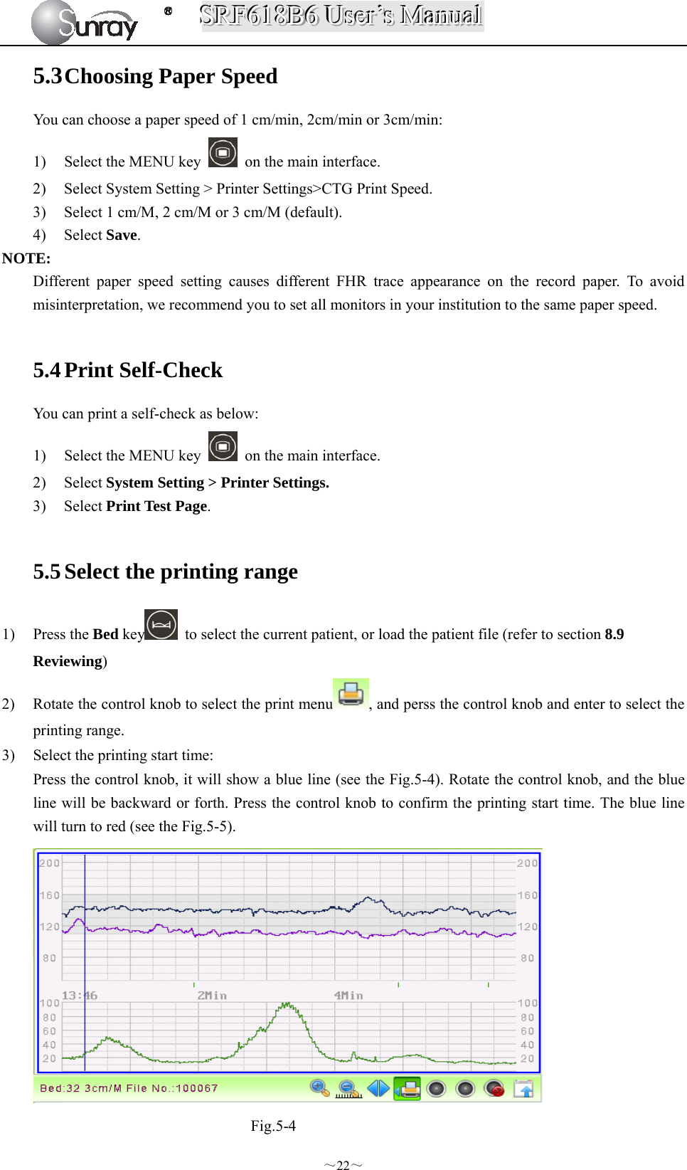 SSSRRRFFF666111888BBB666   UUUssseeerrr’’’sss   MMMaaannnuuuaaalll  ～22～ 5.3 Choosing Paper Speed You can choose a paper speed of 1 cm/min, 2cm/min or 3cm/min: 1) Select the MENU key    on the main interface. 2) Select System Setting &gt; Printer Settings&gt;CTG Print Speed. 3) Select 1 cm/M, 2 cm/M or 3 cm/M (default). 4) Select Save. NOTE: Different paper speed setting causes different FHR trace appearance on the record paper. To avoid misinterpretation, we recommend you to set all monitors in your institution to the same paper speed.  5.4 Print Self-Check   You can print a self-check as below: 1) Select the MENU key    on the main interface. 2) Select System Setting &gt; Printer Settings. 3) Select Print Test Page.  5.5 Select the printing range 1) Press the Bed key   to select the current patient, or load the patient file (refer to section 8.9  Reviewing) 2) Rotate the control knob to select the print menu , and perss the control knob and enter to select the printing range. 3) Select the printing start time:   Press the control knob, it will show a blue line (see the Fig.5-4). Rotate the control knob, and the blue line will be backward or forth. Press the control knob to confirm the printing start time. The blue line will turn to red (see the Fig.5-5).  Fig.5-4 