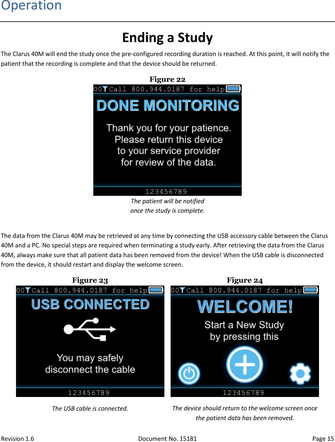 Revision 1.6 Document No. 15181 Page 15  Operation Ending a Study The Clarus 40M will end the study once the pre-configured recording duration is reached. At this point, it will notify the patient that the recording is complete and that the device should be returned. Figure 22  The patient will be notified  once the study is complete.  The data from the Clarus 40M may be retrieved at any time by connecting the USB accessory cable between the Clarus 40M and a PC. No special steps are required when terminating a study early. After retrieving the data from the Clarus 40M, always make sure that all patient data has been removed from the device! When the USB cable is disconnected from the device, it should restart and display the welcome screen. Figure 23  Figure 24  The USB cable is connected. The device should return to the welcome screen once the patient data has been removed. 