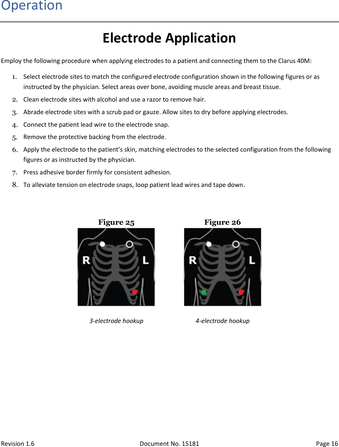 Revision 1.6 Document No. 15181 Page 16  Operation Electrode Application Employ the following procedure when applying electrodes to a patient and connecting them to the Clarus 40M: 1. Select electrode sites to match the configured electrode configuration shown in the following figures or as instructed by the physician. Select areas over bone, avoiding muscle areas and breast tissue. 2. Clean electrode sites with alcohol and use a razor to remove hair. 3. Abrade electrode sites with a scrub pad or gauze. Allow sites to dry before applying electrodes. 4. Connect the patient lead wire to the electrode snap. 5. Remove the protective backing from the electrode. 6. Apply the electrode to the patient’s skin, matching electrodes to the selected configuration from the following figures or as instructed by the physician. 7. Press adhesive border firmly for consistent adhesion. 8. To alleviate tension on electrode snaps, loop patient lead wires and tape down.   Figure 25   Figure 26   3-electrode hookup 4-electrode hookup    