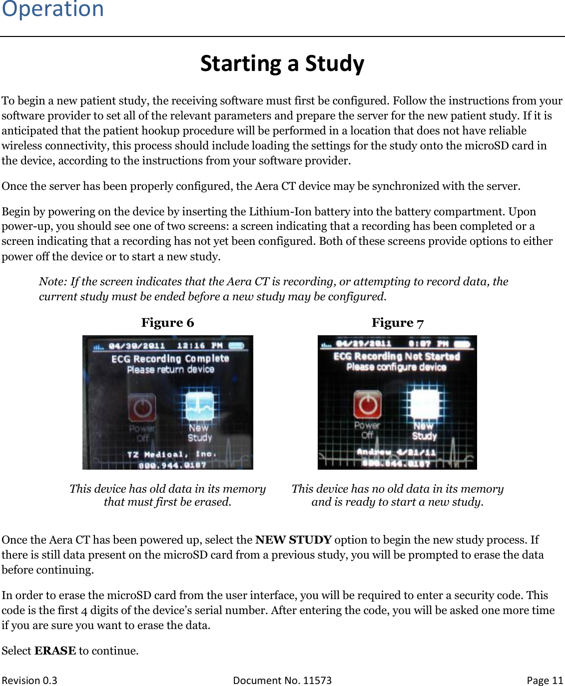  Revision 0.3 Document No. 11573 Page 11   Operation Starting a Study To begin a new patient study, the receiving software must first be configured. Follow the instructions from your software provider to set all of the relevant parameters and prepare the server for the new patient study. If it is anticipated that the patient hookup procedure will be performed in a location that does not have reliable wireless connectivity, this process should include loading the settings for the study onto the microSD card in the device, according to the instructions from your software provider. Once the server has been properly configured, the Aera CT device may be synchronized with the server. Begin by powering on the device by inserting the Lithium-Ion battery into the battery compartment. Upon power-up, you should see one of two screens: a screen indicating that a recording has been completed or a screen indicating that a recording has not yet been configured. Both of these screens provide options to either power off the device or to start a new study.  Note: If the screen indicates that the Aera CT is recording, or attempting to record data, the current study must be ended before a new study may be configured. Figure 6 Figure 7    This device has old data in its memory that must first be erased.  This device has no old data in its memory and is ready to start a new study.  Once the Aera CT has been powered up, select the NEW STUDY option to begin the new study process. If there is still data present on the microSD card from a previous study, you will be prompted to erase the data before continuing.  In order to erase the microSD card from the user interface, you will be required to enter a security code. This code is the first 4 digits of the device’s serial number. After entering the code, you will be asked one more time if you are sure you want to erase the data.  Select ERASE to continue.  