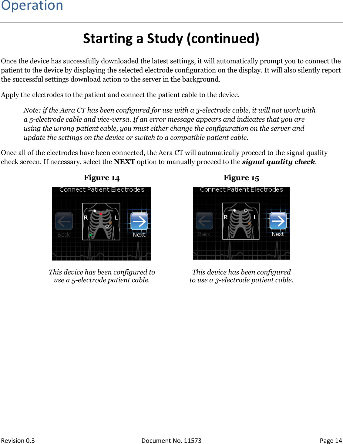  Revision 0.3 Document No. 11573 Page 14  Operation Starting a Study (continued) Once the device has successfully downloaded the latest settings, it will automatically prompt you to connect the patient to the device by displaying the selected electrode configuration on the display. It will also silently report the successful settings download action to the server in the background.  Apply the electrodes to the patient and connect the patient cable to the device.  Note: if the Aera CT has been configured for use with a 3-electrode cable, it will not work with a 5-electrode cable and vice-versa. If an error message appears and indicates that you are using the wrong patient cable, you must either change the configuration on the server and update the settings on the device or switch to a compatible patient cable.  Once all of the electrodes have been connected, the Aera CT will automatically proceed to the signal quality check screen. If necessary, select the NEXT option to manually proceed to the signal quality check. Figure 14 Figure 15    This device has been configured to use a 5-electrode patient cable.  This device has been configured  to use a 3-electrode patient cable.    