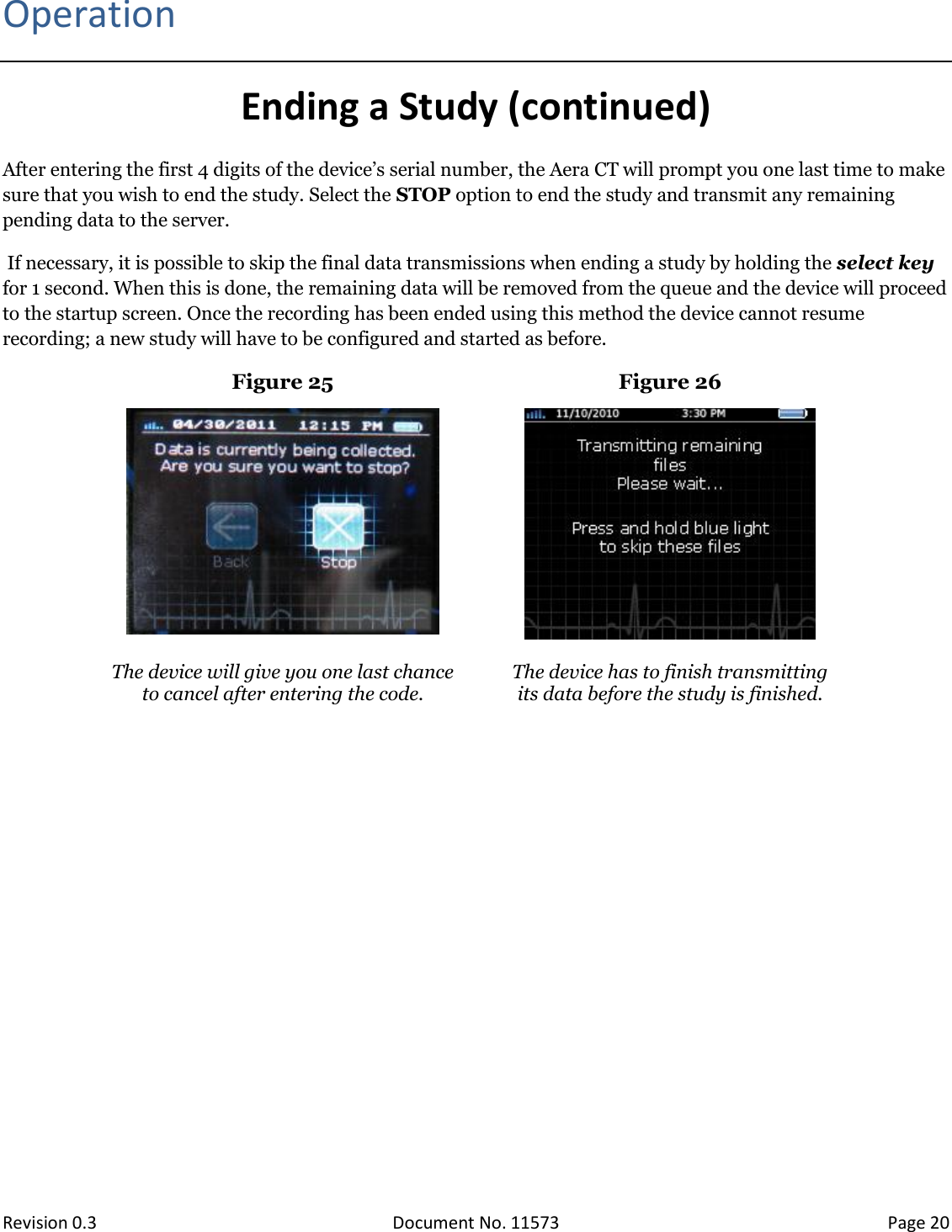  Revision 0.3 Document No. 11573 Page 20  Operation Ending a Study (continued) After entering the first 4 digits of the device’s serial number, the Aera CT will prompt you one last time to make sure that you wish to end the study. Select the STOP option to end the study and transmit any remaining pending data to the server.  If necessary, it is possible to skip the final data transmissions when ending a study by holding the select key for 1 second. When this is done, the remaining data will be removed from the queue and the device will proceed to the startup screen. Once the recording has been ended using this method the device cannot resume recording; a new study will have to be configured and started as before. Figure 25 Figure 26    The device will give you one last chance  to cancel after entering the code.  The device has to finish transmitting  its data before the study is finished.   