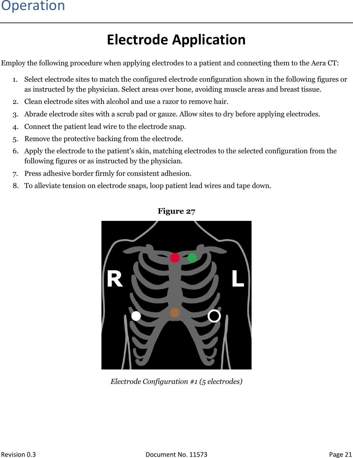  Revision 0.3 Document No. 11573 Page 21  Operation Electrode Application Employ the following procedure when applying electrodes to a patient and connecting them to the Aera CT: 1. Select electrode sites to match the configured electrode configuration shown in the following figures or as instructed by the physician. Select areas over bone, avoiding muscle areas and breast tissue. 2. Clean electrode sites with alcohol and use a razor to remove hair. 3. Abrade electrode sites with a scrub pad or gauze. Allow sites to dry before applying electrodes. 4. Connect the patient lead wire to the electrode snap. 5. Remove the protective backing from the electrode. 6. Apply the electrode to the patient’s skin, matching electrodes to the selected configuration from the following figures or as instructed by the physician. 7. Press adhesive border firmly for consistent adhesion. 8. To alleviate tension on electrode snaps, loop patient lead wires and tape down.  Figure 27   Electrode Configuration #1 (5 electrodes) 