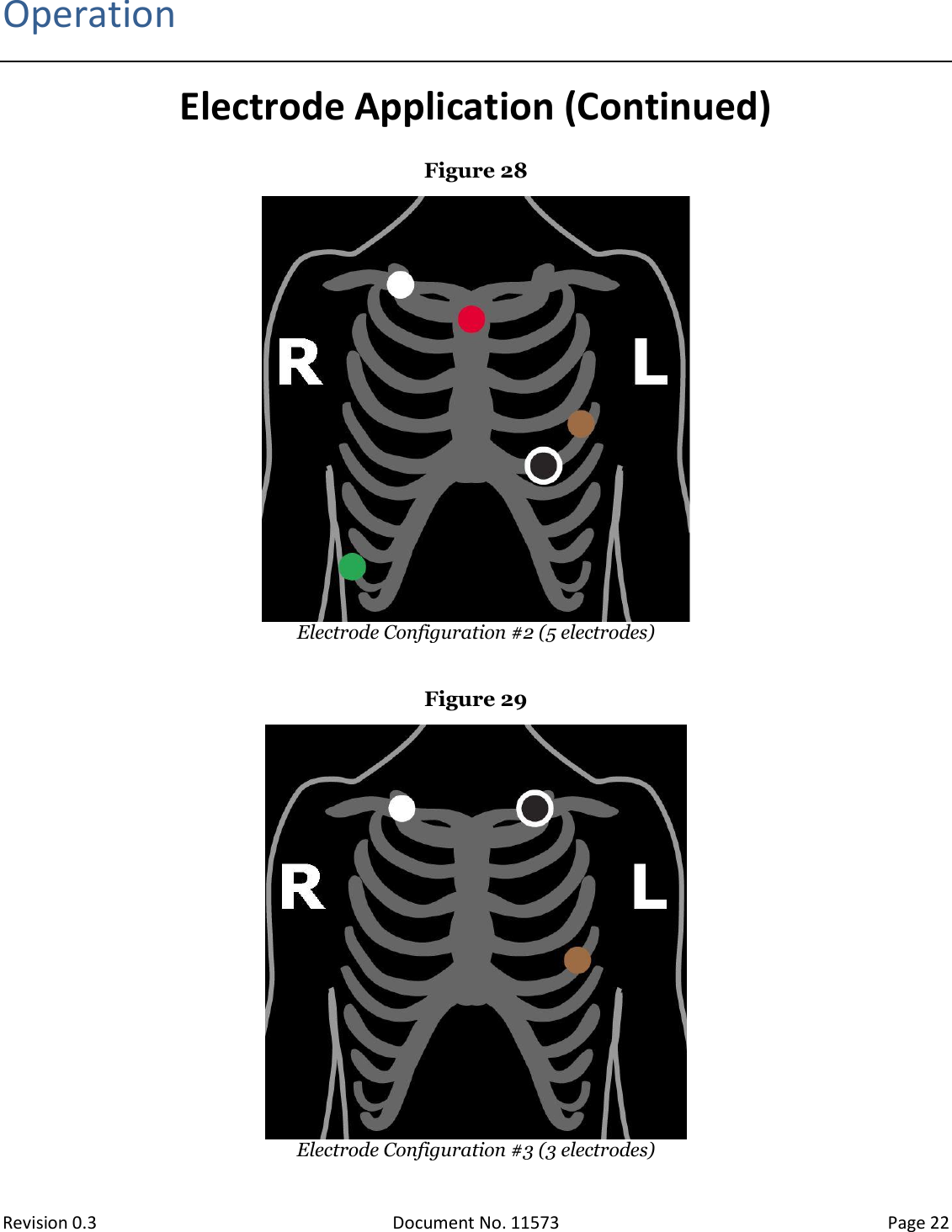  Revision 0.3 Document No. 11573 Page 22  Operation Electrode Application (Continued) Figure 28  Electrode Configuration #2 (5 electrodes)  Figure 29  Electrode Configuration #3 (3 electrodes) 