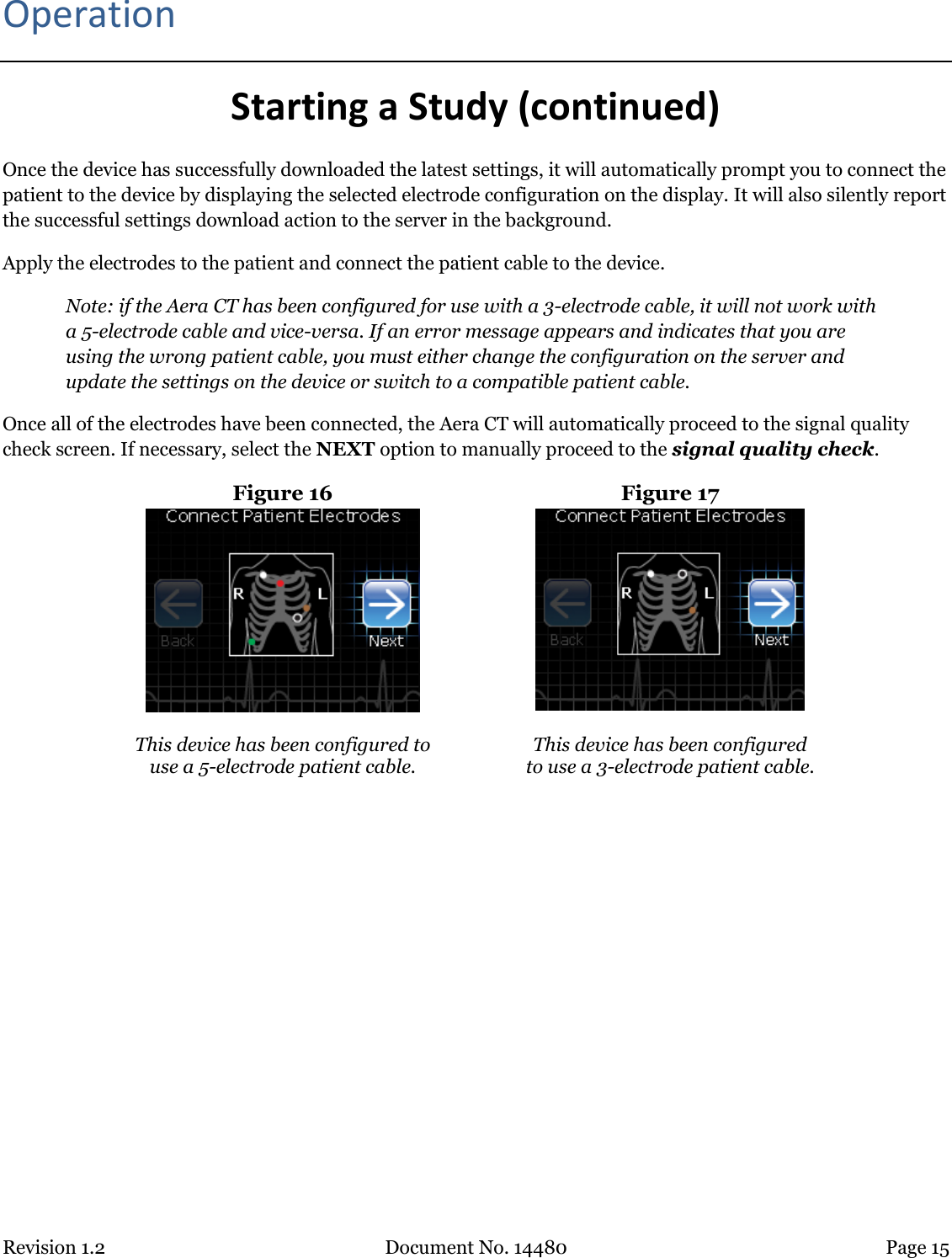 Revision 1.2 Document No. 14480 Page 15  Operation Starting a Study (continued) Once the device has successfully downloaded the latest settings, it will automatically prompt you to connect the patient to the device by displaying the selected electrode configuration on the display. It will also silently report the successful settings download action to the server in the background.  Apply the electrodes to the patient and connect the patient cable to the device.  Note: if the Aera CT has been configured for use with a 3-electrode cable, it will not work with a 5-electrode cable and vice-versa. If an error message appears and indicates that you are using the wrong patient cable, you must either change the configuration on the server and update the settings on the device or switch to a compatible patient cable.  Once all of the electrodes have been connected, the Aera CT will automatically proceed to the signal quality check screen. If necessary, select the NEXT option to manually proceed to the signal quality check. Figure 16  Figure 17   This device has been configured to use a 5-electrode patient cable.  This device has been configured  to use a 3-electrode patient cable.    